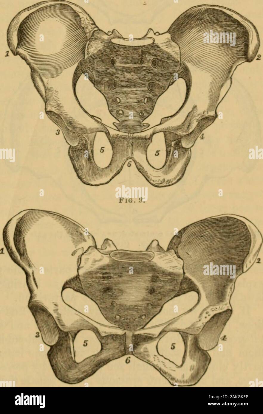 Ein System von Hebammen: Einschließlich der Erkrankungen während der Schwangerschaft und der Puerperalen Zustand. l gezeigt kranke Feigen. 8 Abb. 8. und 9., in dem die Zahlen 1 und 2 repräsentieren die Extremi- bindungen der breitesten trans-vers Durchmesser des oberen oder falsch Becken: 3 und 4 sind die acetab-ula, rechts und links: 5,5, der Schilddrüse oder Obtu -- steingrab: und 6, der orarch subpubic Winkel. Thosewhich Thediffereexhibited sind vorhanden Beti eine normale männliche andfemale Becken iii Mitte dle Alter: weder in der mi., während bei der Frau sind es von den Kranken t [00 erreicht. Von oben und von der vorderen gesehen, die im rechten Winkel bis zum Rand des.iml fem Stockfoto