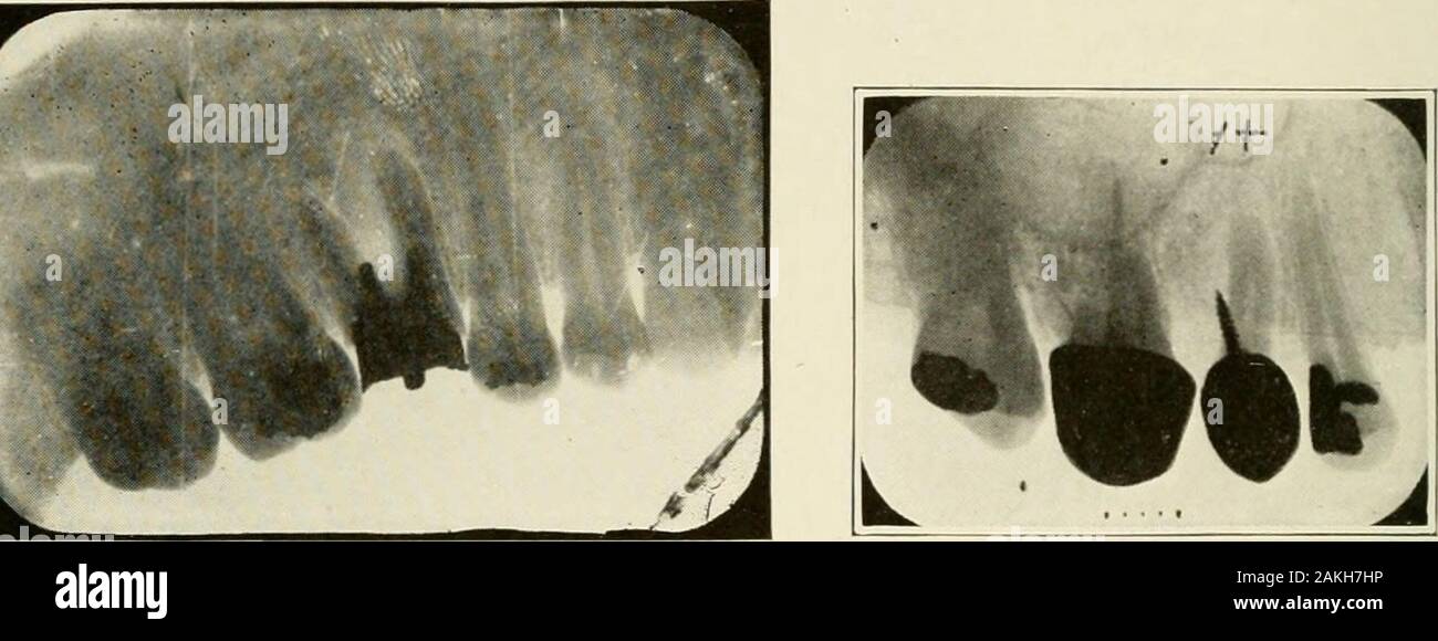 Allgemeine und zahnmedizinischen Pathologie mit besonderer