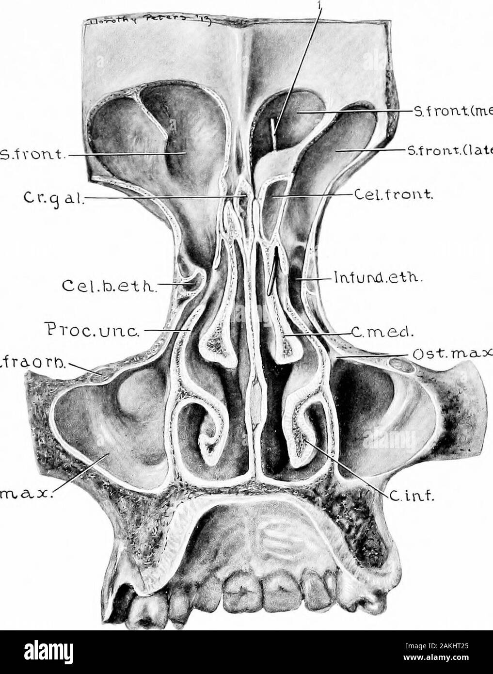 Entwicklung und Anatomie des nasalen Zubehör Nebenhöhlen im Menschen; die Beobachtungen auf zwei Hundert und neunzig seitliche Nasenwände basiert, zeigt die verschiedenen Stufen und Arten der Entwicklung der Zubehör sinus Bereiche aus dem 60. Tag des fötalen Lebens zu fortgeschrittenen Reife. Abb. 51. - Muster 19 Jahre, sieben Monate und 15 DaysOld. (Serie D, Nr. 88.) medianen Sagittalschnitt. Den vorderen Teil der Concha Medien und aportion des frontalen Knochen entfernt wurden die anterolaterale nasalwall zu zeigen. Die Lücke semilunaris wird in diesem Fall ungewöhnlich kurz. B. eth., Bulla ethmoidalis; C.m Stockfoto