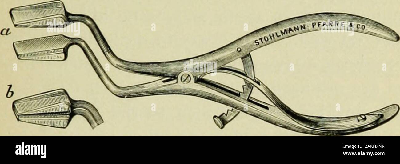Ein Handbuch der modernen Theorie und Technik der chirurgischen Asepsis. Anästhesie. 279 Die maxillae. Der Schriftsteller severalmodifications dieses nützliche Instrument entwickelt hat, die mostimportant ist die Einrichtung ofgrooves in die dreieckige Öffnung - Stück theforceps (Abb. 61, b). Nach dieser Änderung sepa -- (Abb. 61, a) eingeführt wird sie gedreht wird Seite - klug, und durch die Forcierung der Nuten in die Zähne. Abb. 61.- Becks geändert Oberkiefer - Dreschwerk. Das Instrument Herausfallen verhindert werden. Die Entfernung von Schleim ist somit leicht gemacht. Wenn ordentlichen Mittel nicht ausreichen, um restorebreathing, Stockfoto