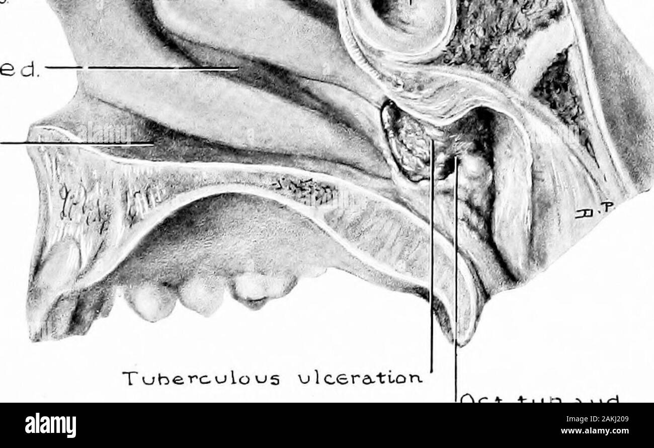 Entwicklung und Anatomie des nasalen Zubehör Nebenhöhlen im Menschen