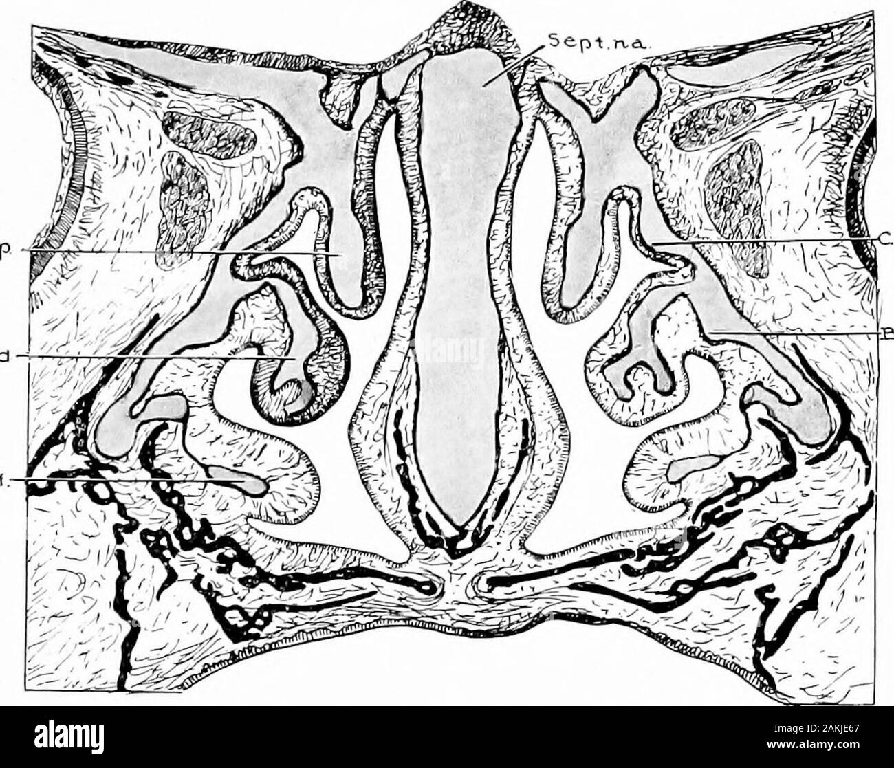 Entwicklung und Anatomie des nasalen Zubehör Nebenhöhlen im Menschen; die Beobachtungen auf zwei Hundert und neunzig seitliche Nasenwände basiert, zeigt die verschiedenen Stufen und Arten der Entwicklung der Zubehör sinus Bereiche aus dem 60. Tag des fötalen Lebens zu fortgeschrittenen Reife. Eit suchspecimens sind so selten von anderen Beobachtern der embryo-Logik und fetalen Bedingungen gefunden, scheint es wahrscheinlicher, dass Dienummer in jedem gegebenen Fall gefunden mehr hängt von theextent auf die Differenzierung durchgeführt wurde als uponthe Absicherung von conchse bereits gebildet. Zuckerkandl givesthree ethmoidal conchse wie die typischen Stockfoto