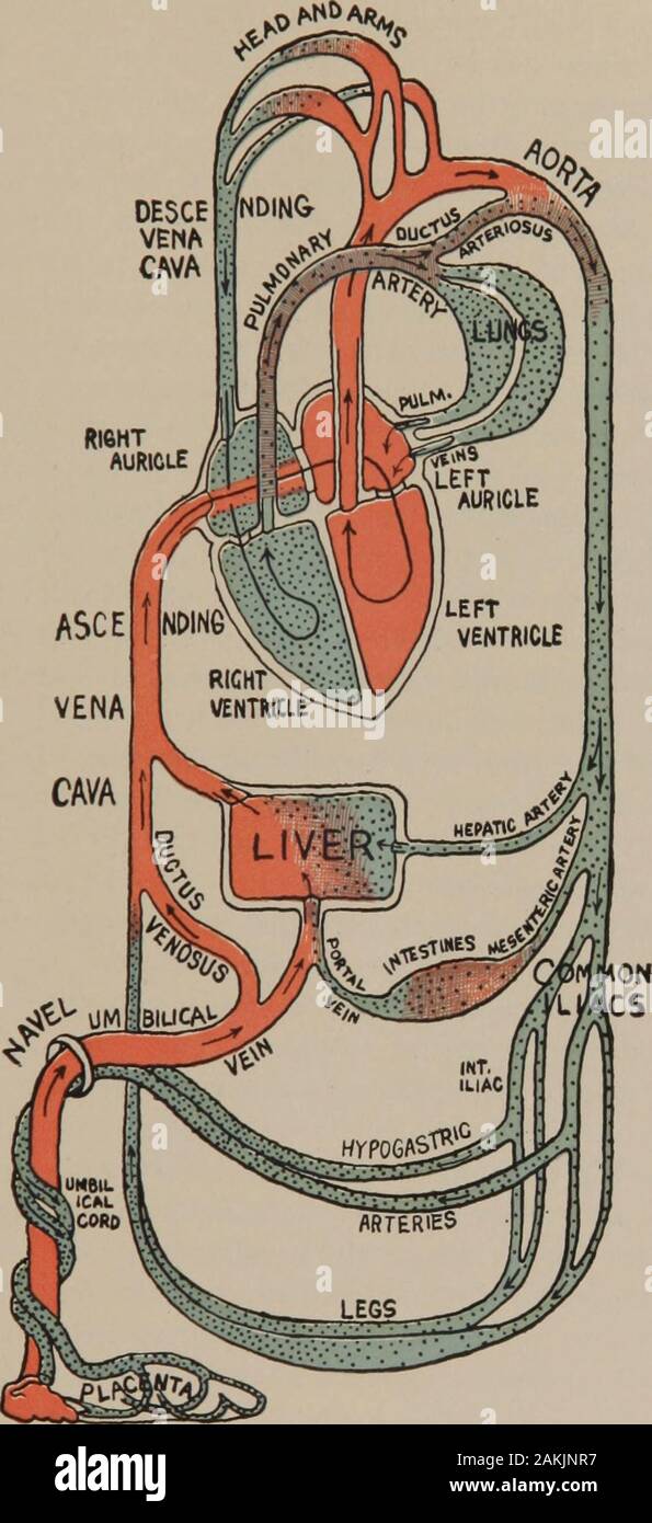 Eine Krankenschwester Handbuch der Geburtshilfe. I I arteriellen Blutes venöse Blut Abb. 28.- Diagramm der Verkehr nach der Geburt. Nach Art. Fetale Zirkulation.. | | arteriellen BloodVENOUS, Blut Abb. 29.- Diagramm der Verkehr vor der Geburt. Fetale Art. 64 Krankenschwestern HANDBUCH DER GEBURTSHILFE. Länge der Zeit, ist das Foramen ovale, - ein Ventil - wie openingbetween der rechten und linken Öhrchen. Die anderen sind die ductusarteriosus, Anschließen der Aorta und der Arteria pulmonalis; theductus venosus, Anschließen der Vena umbilicalis und der ascendingvena Cava; und die zwei hypogastric Arterien, entspringen aus der internen iliacs und Pa Stockfoto