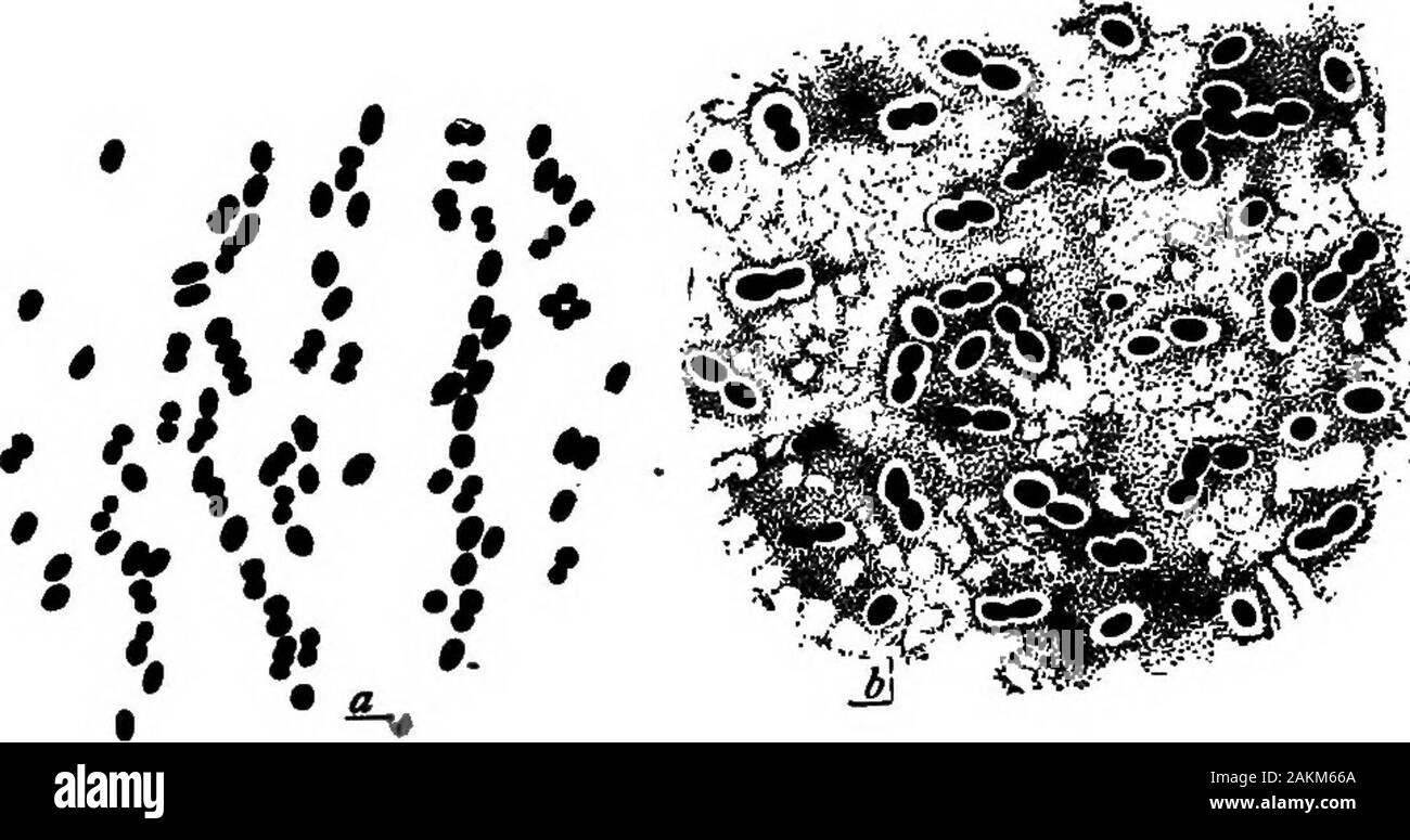 Praktische Molkerei Bakteriologie, für die der Einsatz von Schülern und Studenten, Milchmänner vorbereitet, und alle in die Probleme der Beziehung von Milch zur öffentlichen Gesundheit interessiert sind. - Wirkung der SCHLEIMIGEN MILCH BAC-TERIEN AUF MILCH (rUSSELL) 46 PRAKTISCHE MOLKEREI BAKTERIOLOGIE die Ursache solcher sliminessis, soweit bekannt, die Wachstum: bestimmter Arten von Bakterien. Mehrere verschiedene Arten gefunden wurden, die in der Lage sind, Milch schleimig,:; Die am häufigsten Dieser scheint Schlecht. lactis viscosus (Abb. 24), die wasfirst beschrieben in Europa, und hat später in einem Numberof solche Infektionen in Amerika gefunden worden. Dieser Organismus ist dis weit Stockfoto