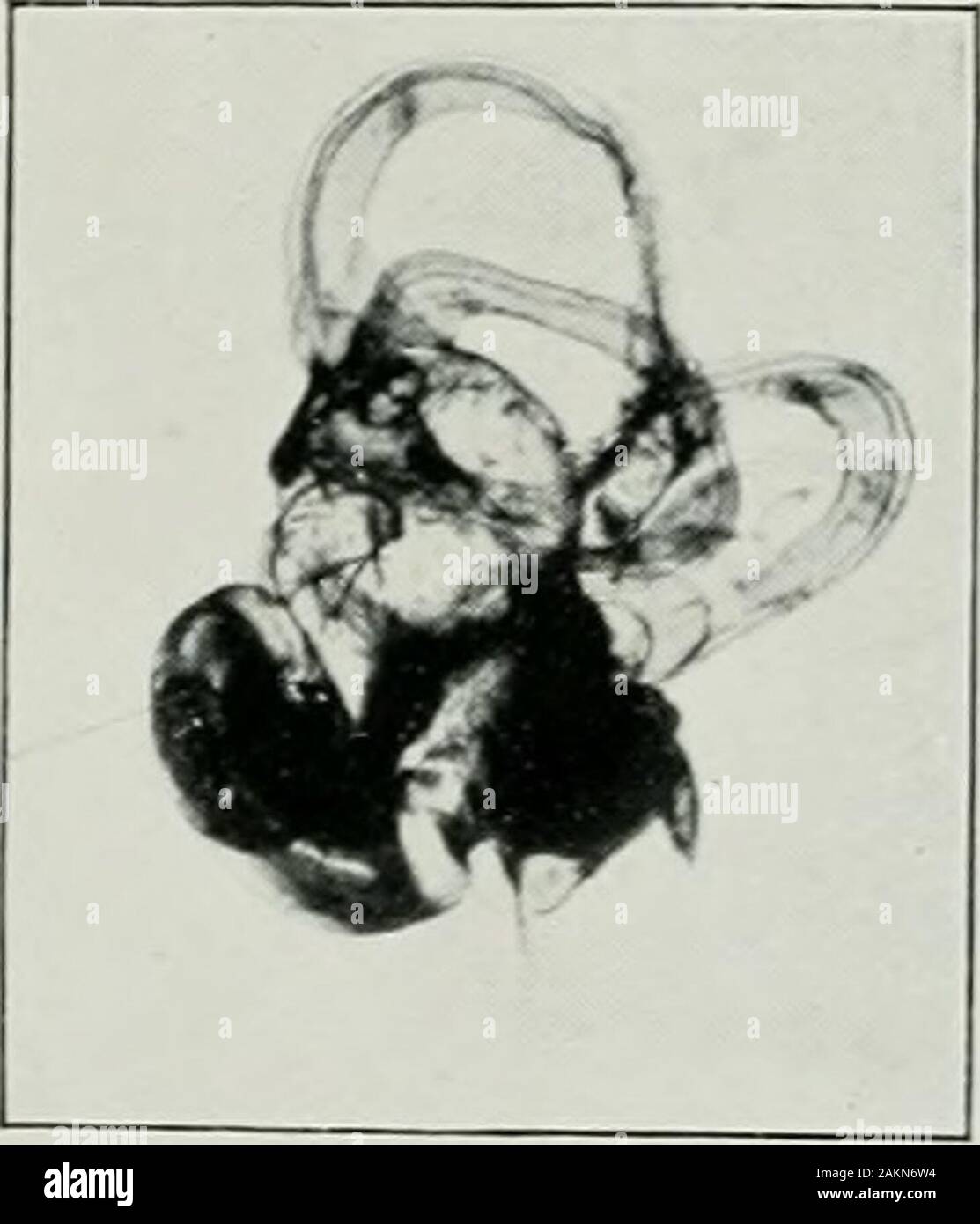 Die Zeitschrift für Ohrenheilkunde und otologie. Abb. 3. Menschliches Labyrinth, natxiral Größe. Übersicht der Hörnerv^ vitli thedura Mater der internen Meatus schwach umrissen. Das Zubehör ampullais auch in dieses Exemplar gesehen. Abb. 4.- Labyrinth uf die Dichtung, natürliche Größe. Eine der Otolithen. yol. XX,/.js. ^ dtard&f Sohn, Imp. Februar 1905.] Rhmology und Otologfy. 79 Die nächste Vorbereitung ist auch der menschlichen Labyrinth, aber es istnicht magnitied. Es ist für den Vergleich mit der sealwhich folgt angezeigt. Das Labyrinth der Dichtung ist offensichtlich die grössere in everyrespect - Cochlea, Aula Stockfoto