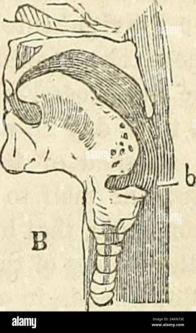 Die Wasser-cure Journal, und Verkünder der Reformen, für die Physiologie, Wassertherapie und die Gesetze des Lebens gewidmet. Luftröhre. Luftröhre. auf Abbn. 2 und 3. Im ersten Beispiel zeigt die narrowopening der obere Teil der Luftröhre, theglottis, der epiglottis b die Frage der Inspiration der Luft zu ermöglichen. Aber wenn wir schlucken, theepiglottis, b, Abb. 3, geschlossen und der oesophagusdarts bis der Teil der Nahrung, ist sentinto im hinteren Teil des Mundes für die purposeof verschlungen zu erhalten. Nun, wenn eine so große flexiblen Leitung Fleisch wie beschrieben in die Kehle, kann sie weder Pass in der oesoph Stockfoto