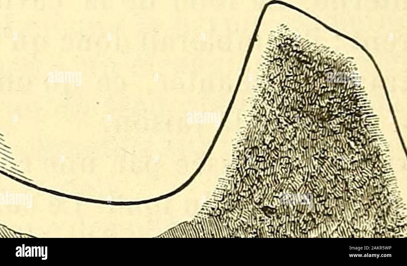 "Traité d'anatomie topographique avec Anwendungen à la Chirurgie. Ich.ji Stockfoto