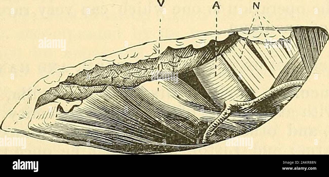 Acromio Fotos und Bildmaterial in hoher Auflösung Alamy