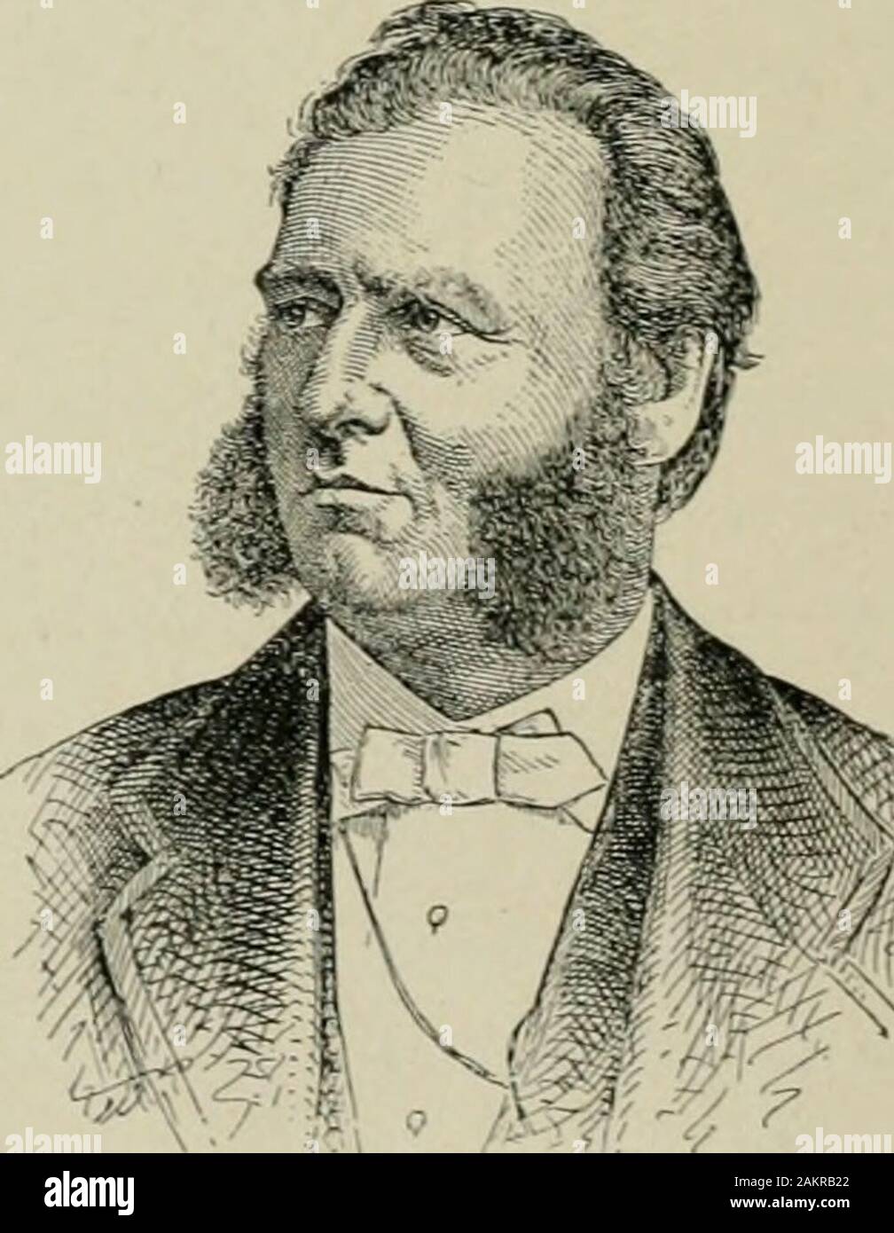 Amerikanische Praxis der Chirurgie: ein vollständiges System der Wissenschaft und die kunst der Chirurgie. dia als - die Position einer Spezialität in surgicalpractice in diesem Land Sumed. Lewis Albert Sayre (1829-1900) war ein nativeof New Jersey und ein Absolvent der TransylvaniaUniversity, Kentucky. Er studierte Medizin inNew York City und studierte an der Collegeof Ärzte und Chirurgen in 1842. In der prosector sameyear wurde er auf den Lehrstuhl ofsurgery in jener Institution ernannt, eine Position, die heheld bis 1852. 1853 war er einer der Besuch der Chirurgen von Bellevue Hospital ernannt. 1861 war er einer der Fou Stockfoto