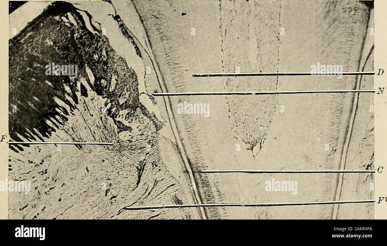 Alveolarfortsatz Stockfotos und bilder Kaufen Alamy