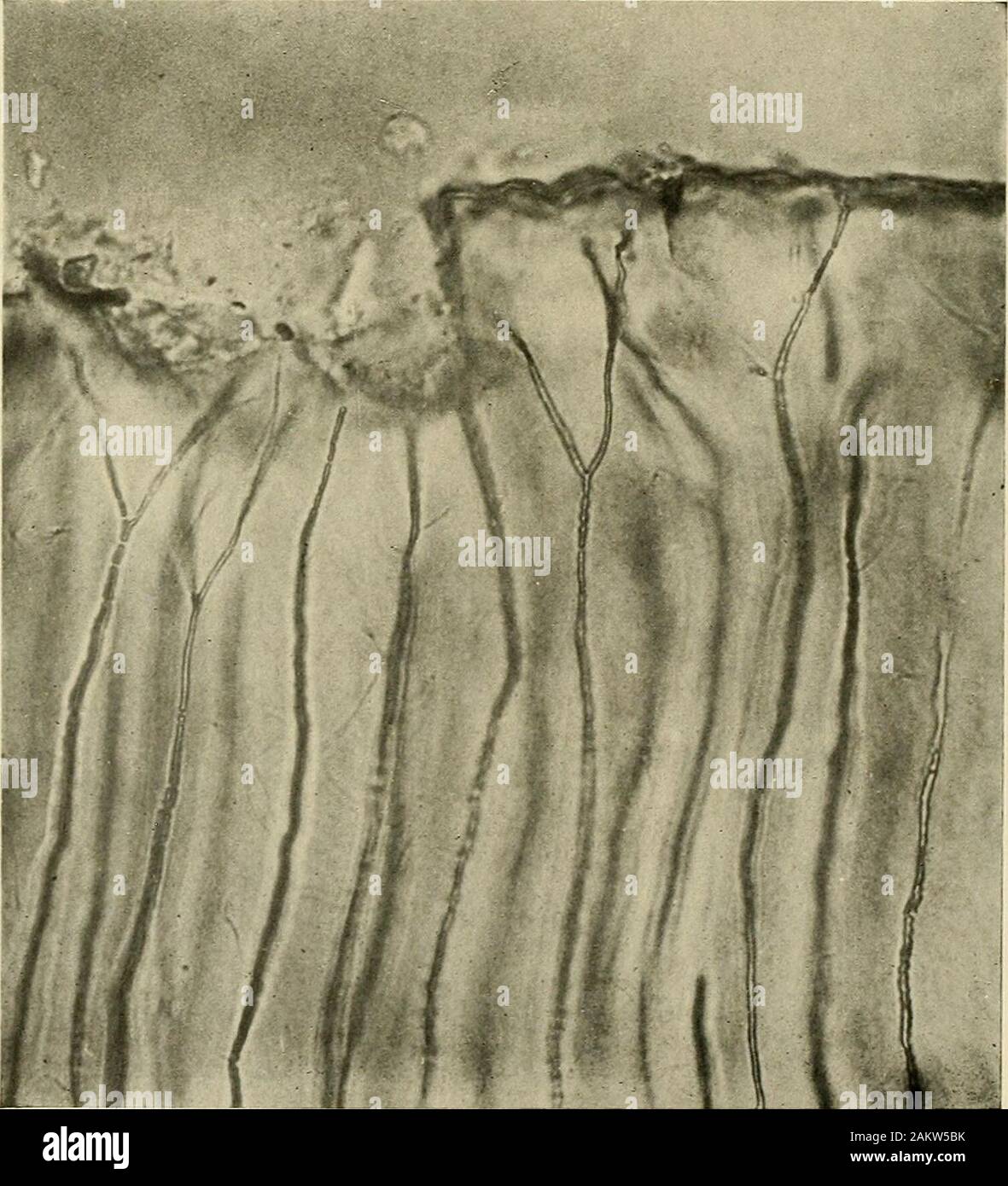 Grundsätze und Praxis der Operative Zahnheilkunde. Dentinal tubuli Wurzelzement Secondary dentin Abb. 155,- Querschnitt Wurzel der menschlichen Bicuspid, die Strahlung der dentinal Tubuli.. Abb. 156.- Normal Dentin bei dento-Emaille Junction, Anzeigen dentinal Tubuli. iY. S.. Xoyes.); • 760. Die HISTOLOGIE DER ZAHNMEDIZINISCHEN Gewebe. 47 Mineralische Materie. Magnesium 1,67 Phosphorsäure 23,70 Sihcates 0,04 Unbestimmt 1,30 löslicher Asche (alkalische Chloriden und Phosphate) 0,54 Calciumcarbonat Calcium carbonate 1,13 0,35 Magnesimn 65.92 Schwarz, in seinen Experimenten auf die Körperliche Zeichen des HumanTeeth, D Stockfoto