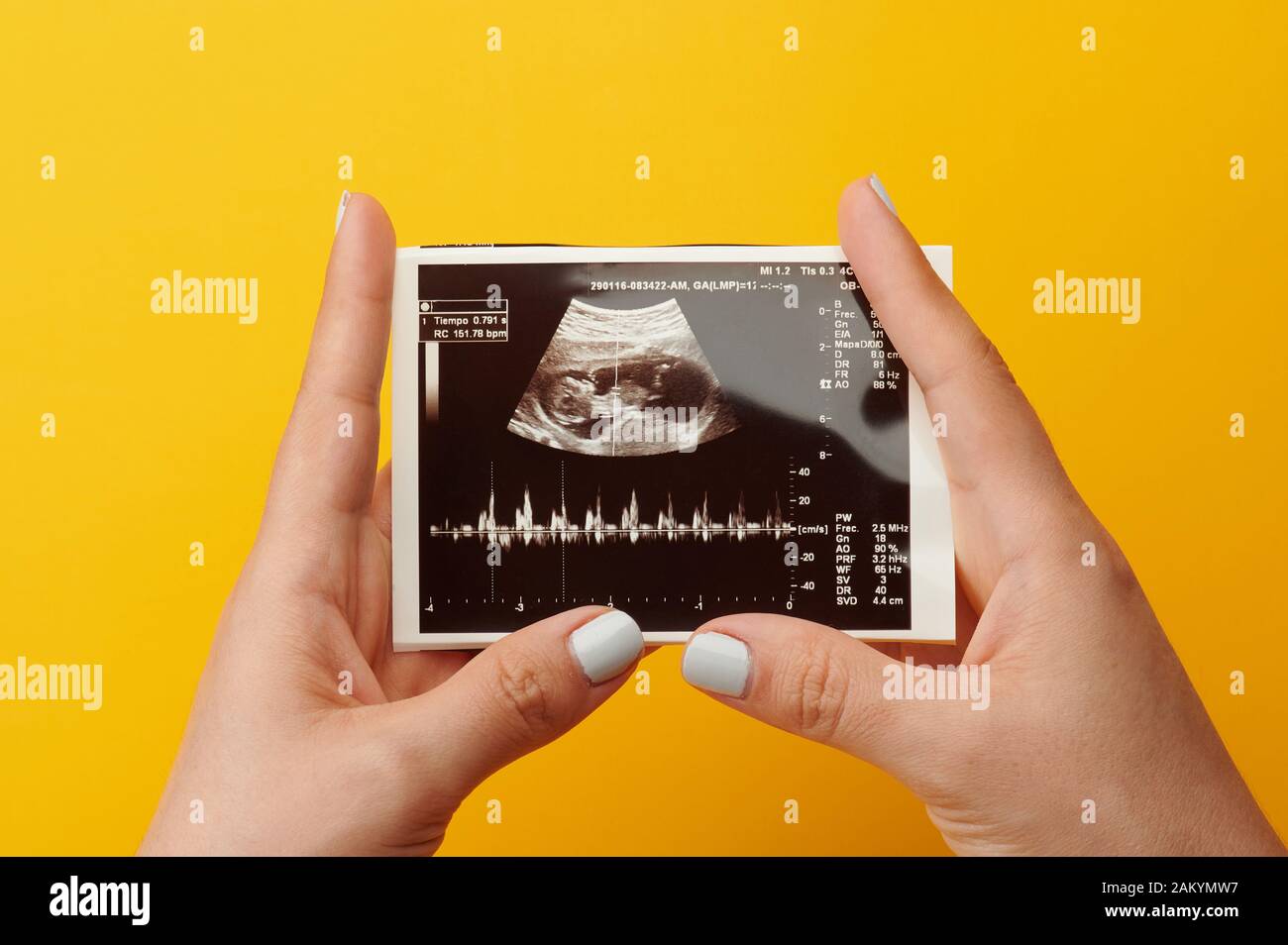 Frau halten Bild von ihr Baby vom Ultraschall check up Stockfoto