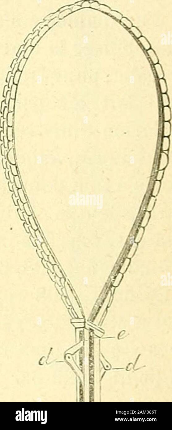 Chirurgie journalière des Hopitaux de Paris: Répertoire de thérapeutique chirurgicale. S: Abb. 60 S. - Écraseurmuni du Porte-chaîne (linstru- est Vu fermé). Abb. G 09. - Porte-chaîne. Abb. 610. - Le porte-clmine dilatant lachaîne. Les Dents de La Crémaillère entailles pratiquéesaux sengrènent dans les Côtes des Deux longues Stiele qui, partant de/, se prolongent AFFECTIOiNS UTÉRINES. 673 dans toute la Länge de linstrument; lorsque La crémaillèreest dirigée vers e?, Les Dents sélèvent au-dessus de ces entailles, etla Chaîne et le porte-chaîne portés librement peuvent être en hautou en b Stockfoto