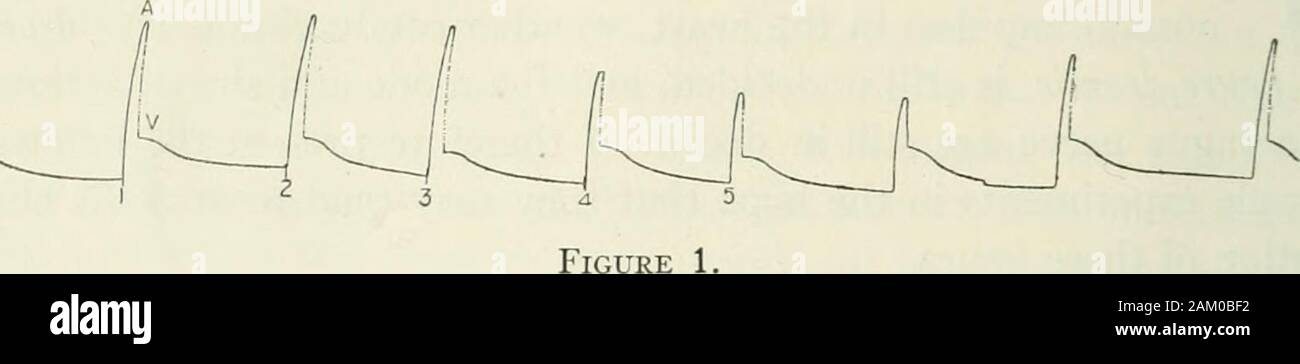 American Journal der Physiologie. ed, für die Bequemlichkeit der Behandlung, die in drei Gruppen. Jede Gruppe soll in einer anderen waythe Persistenz der vagus Auswirkungen auf die Ohrmuschel zu zeigen nach dem productionof Komplette sino-Congelador blockieren. Die allgemeine Methode Verwendung ctgs durch Hebeln an der großen Venen oder sinusand zu einem Der Congelador Anlagen nehmen, nachdem das Herz hat Freedfrom der Anhänge, mit Ausnahme der an der Basis. Die koronararterien Nerv und veinare Schnitt in allen der Experimente und eine Schelle, welche der modifiedGaskell Typ ist, wird angewendet, und die Kompression produziert suf Stockfoto