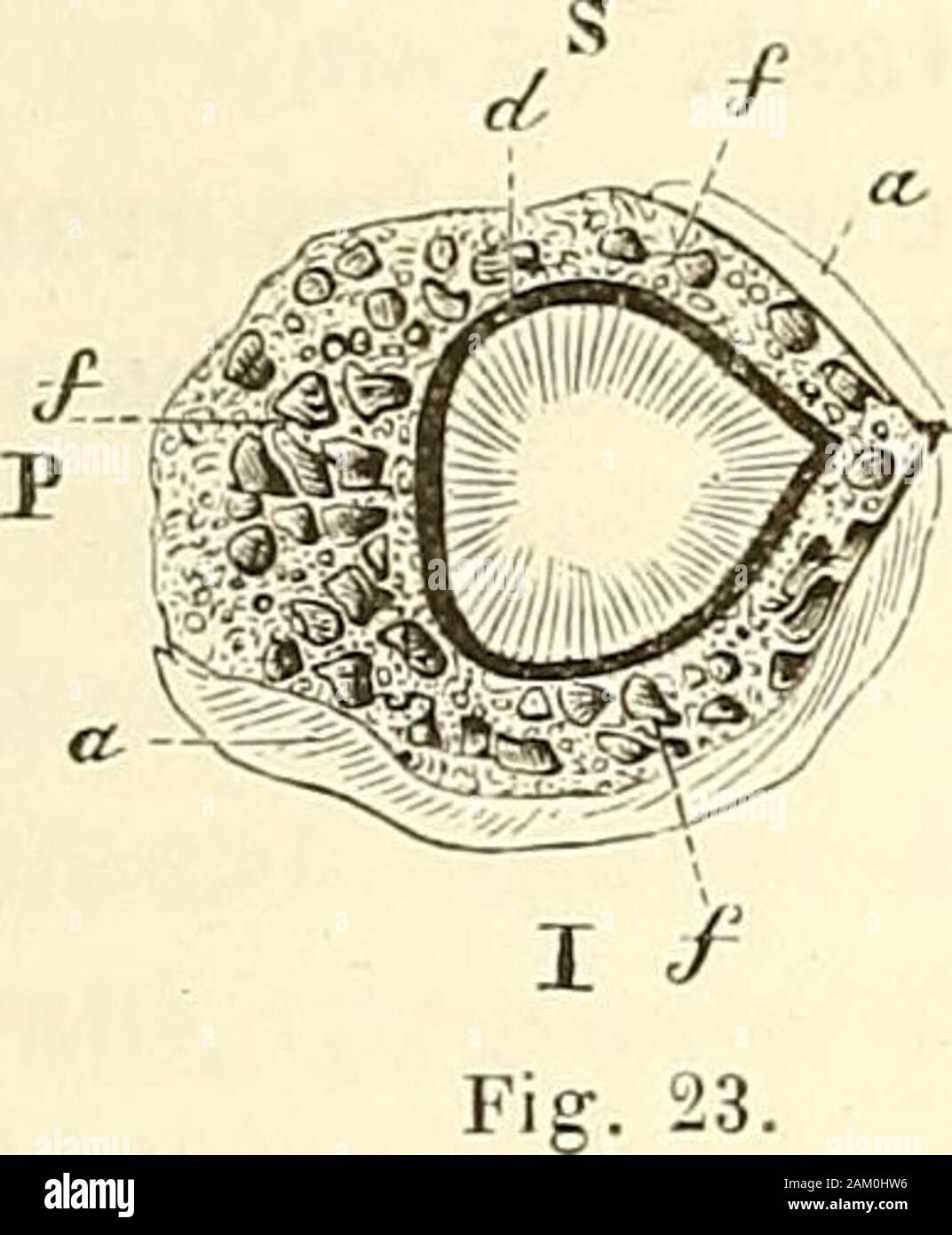 "Traité d'anatomie topographique avec Anwendungen à la Chirurgie. posé à attribuer à la forme anormale du Conduit auditif uneinfluence considérable sur la production de cette maladie si Kommune, si Grave, absolument Incu-Sivberichterstattungen, et dont la Ursache nous échappe. Laction directe du Froid sur la Membran du tympan et surla Caisse, que ne protègent plus à la manière Dun écran Les courbures du Conduit, doitjouer auditif un rôle wichtig; et, si cette maladie est héréditaire, Mesz que la forme Du conduit prédispose auditifqui y est Elle-même héréditaire. FORME ET ABMESSUNGEN DU CONDUIT AUDITIF EXTERN Stockfoto