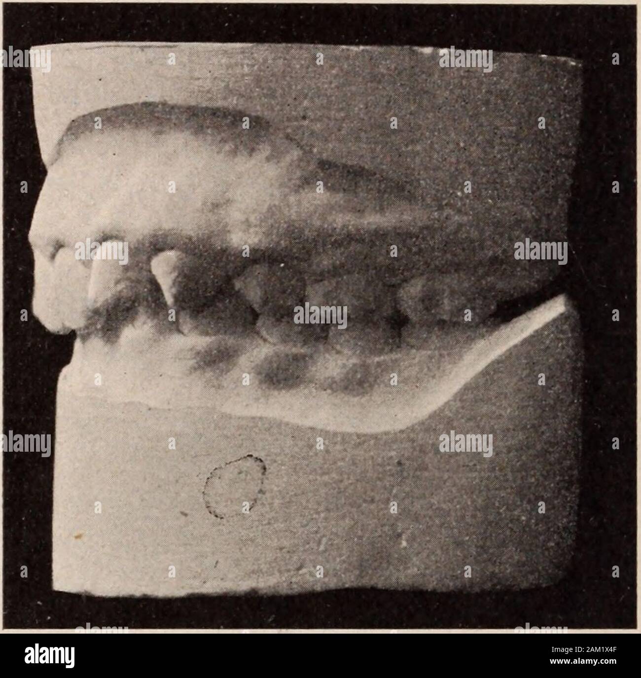 Kaumuskulatur Fotos und Bildmaterial in hoher Auflösung Alamy