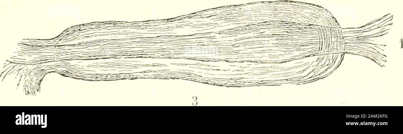 "Traité d'anatomie humaine. tre Elles des espaces Libres, arrondis ou Eizellen - laires, Dans lesquels cheminent des vaisseaux sanguins et lymphatiques. Kessel les considère comme ayant La même Signifikation que le Système lacu - naire que Nous avons signalé rouclie précédemment dans la Moyenne de la mem-brane du tympan. En dehors des replis muqueux que Nous avons décrits plus Haut entre les paroisde la Caisse et la Chaîne desosselets, Politzer ein signaléà la Oberfläche libre de la mu-queuse tympanique un-CER-tain Nombre de cordonsmembraneux qui. Lui gießen. seraient des reliquats dutissu conjonctif gélatineu Stockfoto