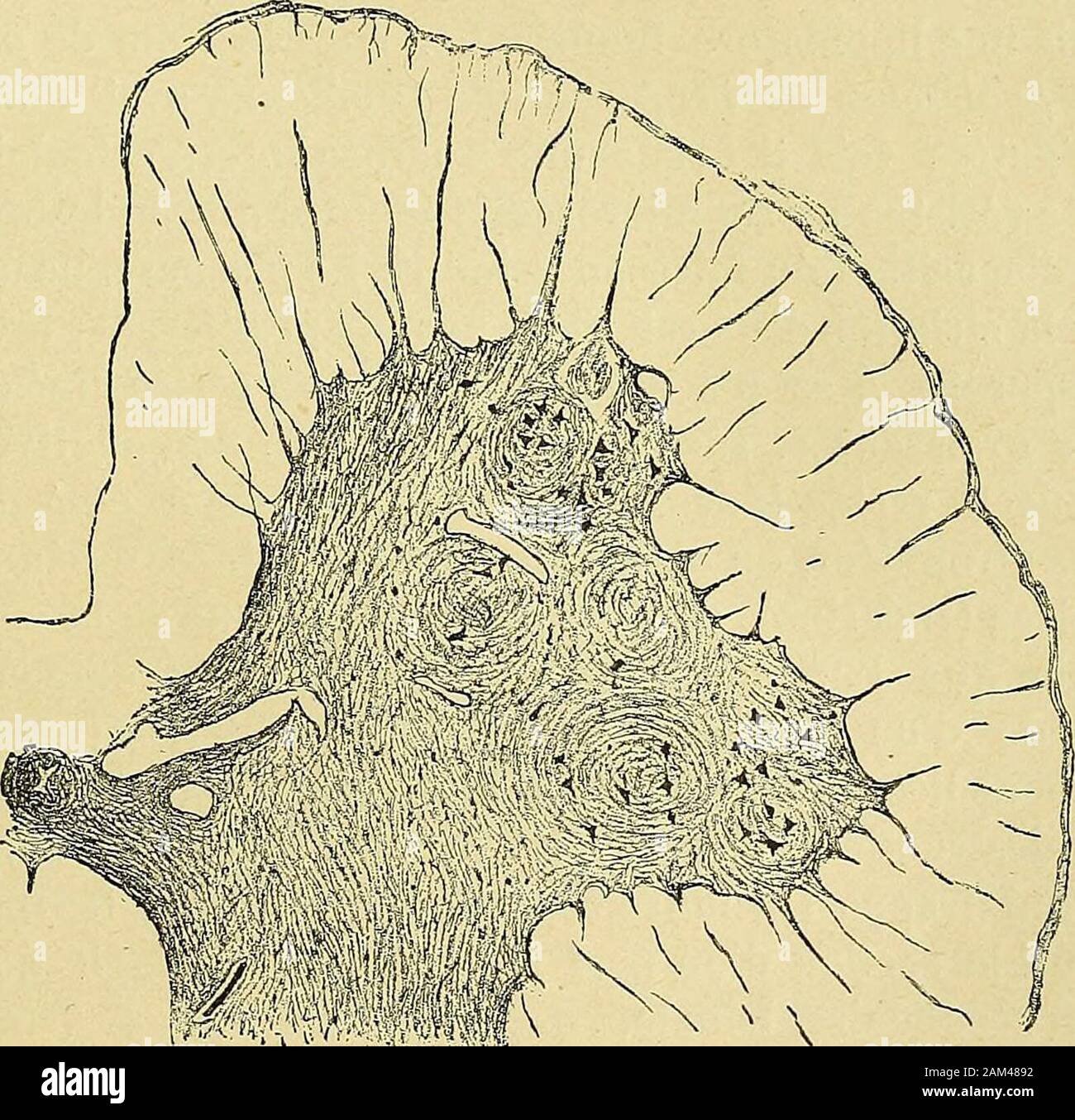 "Traité des Maladies de la Moelle épinière. Fis. 43.. Abb. - 43 et 44. - Paralysie infantile unilatérale gauche. - Coupé transversale de larégion lombaire Vue à un plus fort grossissement (Obj. Ein "Oc. 1 façonà Zeissl) de mieux montrer la différence entre La Corne antérieure Gauche (saine) (Abb. 44) etla Corne antérieure Gauche (MALADE), et la disparition de la plupart des cellules decette Corne. 150 J. DEJERINE ET THOMAS. - MALADIES DE LA MOELLE. Probst a trouvé une Atrophie de la région gyriismarginalis rolandique, du, du, du faisceau gyriis angularis pyramidenförmigen dans toute sonétendue et du cerv Stockfoto