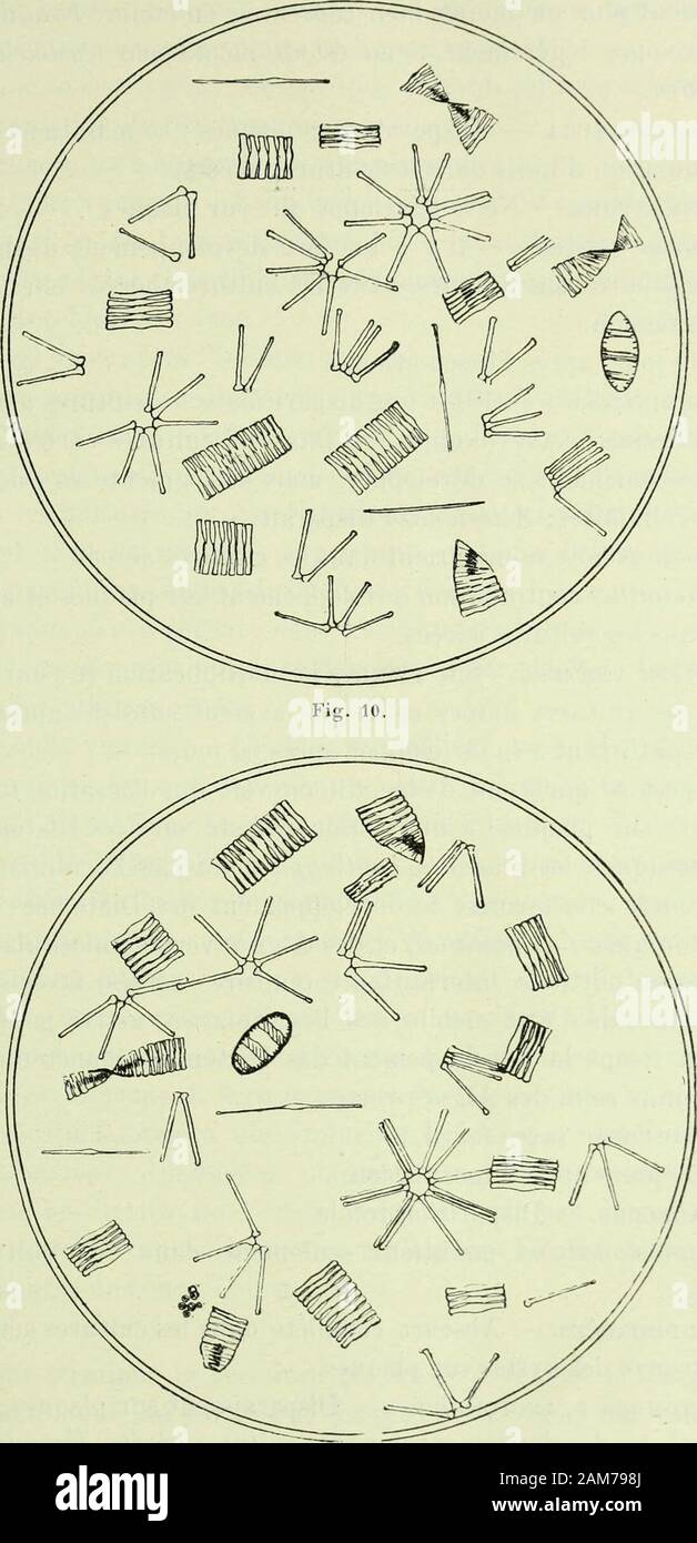 Archive Körperbau et des sciences naturelles. Abb. 9.- Kulturen sous cloche Jaune (daprès Fotografien). DES EAUX DU LAC DE GENÈVE 335. Abb. 11.- Kulturen sous cloche Bleue (daprès Fotografien 336 ÉTUDE PHYT 0 PLANCT 0 NIQUE maintient mehr oder weniger Bien conservée en Étoile; Fragilariase développe légèrement, il en Est de même Cyclotella etMelosira gießen. Omatopleura. - Disparaît sur Plaketten; se maintient avecaccumulation dhuile dans les Kulturen aérées. Achnanthes. - Ne se développe que sur Plaques. Algues vertes. - Il y a un fort développement dAlguesuni - cellulaires sur Plaketten, dans les Cu Stockfoto