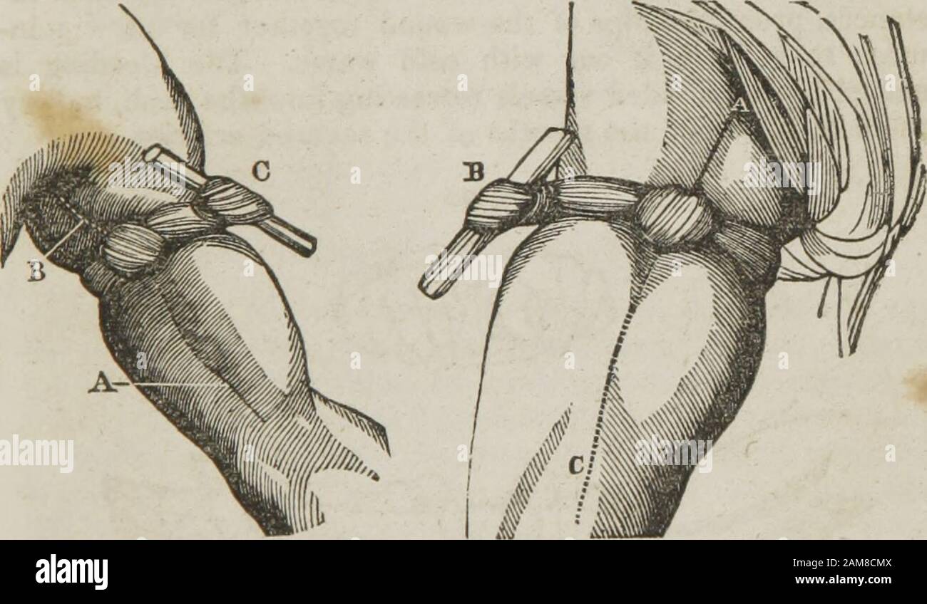 Anatomie und Physiologie: Entwickelt für Akademien und Familien. Eine Wunde im Fuß, Bein oder Oberschenkel, ein Bandit blutet sehr, die Blutung sollte unheilvoll verhaftet werden, oder das Leben wird geopfert. Dies kann durch gewaltsame Kompression mit drei oder vier Lingern einer oder beider Hände, auf dem oberen und inneren Teil des Oberschenkels, über dem Verlauf der Hauptschlagader des Oberschenkels geschehen. Oder Kompressionin der Wunde auf den offenen Mund des blutenden Gefäßes setzen. Dies ist das sichersten und besten Mittel, um die Blutung mit Vorsureto zu verhaften. Wenn die Wunde im oberen Teil des Oberschenkels liegen sollte, dann ist dies der Fall Stockfoto