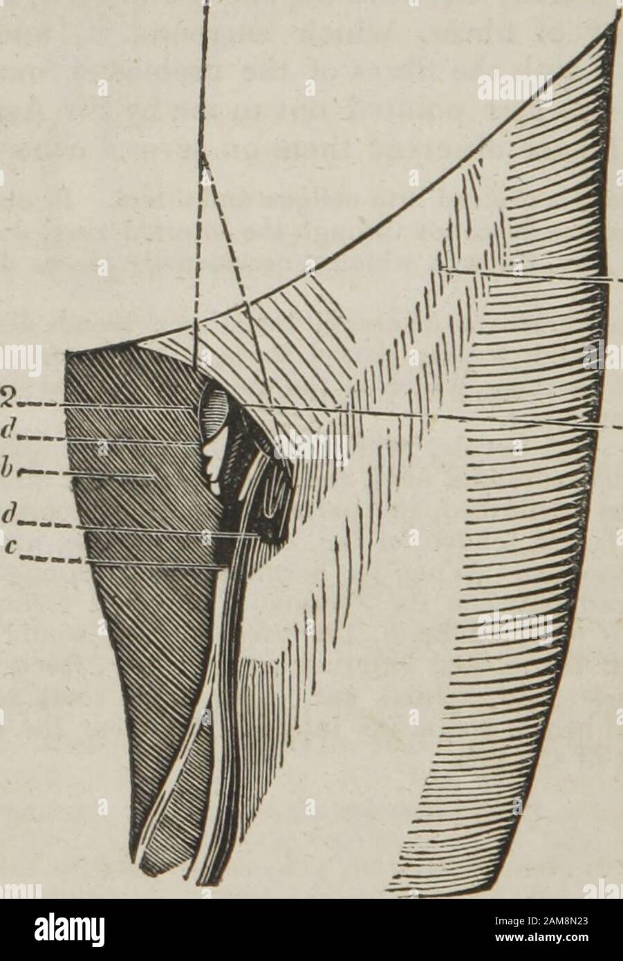 Der Führer des Dissektors oder der Begleiter des Studenten: Illustriert durch zahlreiche Holzschnitte, die die Zerlegung jedes Körperteils des Menschen deutlich zeigen und erklären. Die drei Sitze der Schräganreihernie sind, am inneren Ring, in der Nähe des äußeren Rings und am Hals des Sacks. 212 DIE DISSEKTOREN FÜHREN. ABSCHNITT DER ANGESCHLOSSENEN TEILE WITHFEMORAL-HERNIE. Die Teile der Femoralhernie sollen bei einem dünnen weiblichen Studienteilnehmer vorteilayouslyexaminierten werden. Der Dissektor besteht darin, die Haut sehr vorsichtig zu reflectthe, nachdem sie zuvor die Parstense gerendert hatte. Wenn sie entfernt werden, die Fascia superfici Stockfoto