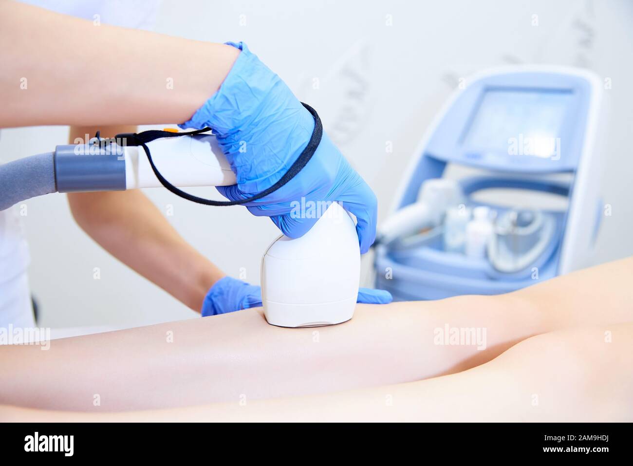 Laserverfahren in der Klinik für ästhetische Kosmetologie. Stockfoto