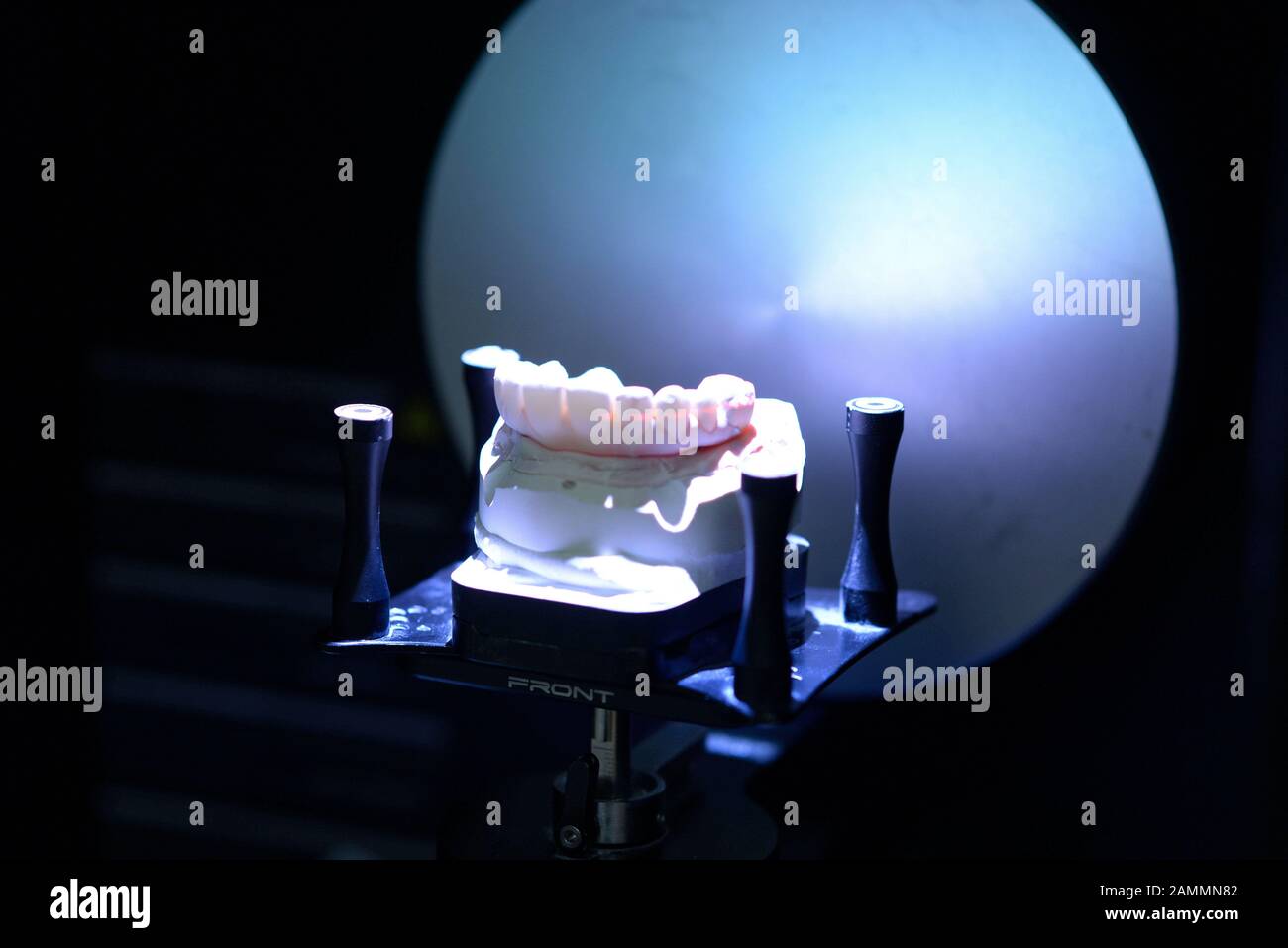In der Implaneo Dental Clinic erhält ein Patient einen neuen Zahnersatz (hier im Labor) mit Implantaten vom 3D-Drucker. [Automatisierte Übersetzung] Stockfoto
