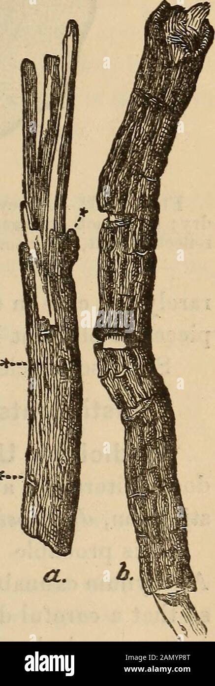 Ein Begleiter der Pharmakopie der Vereinigten Staaten; . Xture von Alkohol und Wasser in der Treibladung von zweihundert Gramm (ca. 8-J- Fluidunzen)Alkohol und einhundert Gramm (ca. 3-J-Fluid-Unzen) Wasser. Weitere Informationen finden Sie auf Seite 451. Dosis: 0,20 bis zwei Kubikzentimeter (3 bis 30 Minuten). Apocynum Androssemifplium, Apocynum Andros^emifolium. Apocyni Androscemifolii Radix-Bitter Root;Dogsbcme. Ursprung.-Apocynum androscemifolium, Linne (Apocynacece). Habitat.-Nordamerika. Verwendetes Teil: Die Wurzel. Beschreibung.-Stücke verschiedener Länge, selten größer als drei oder vier Zoll, und von thr Stockfoto