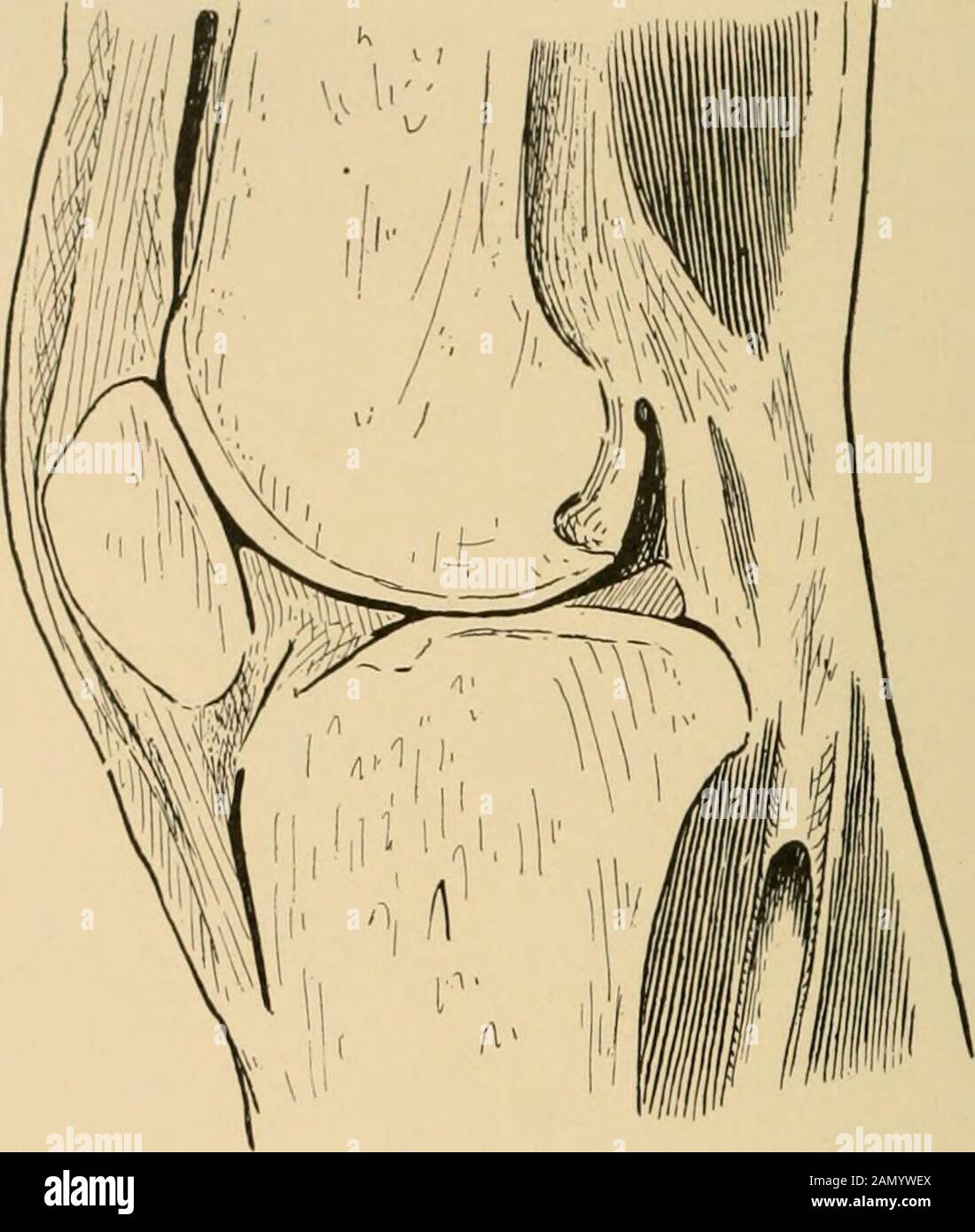 Die Behandlung von Frakturen . Abb. 444.-Horizontal gefrorener Abschnitt des Kniegelenks, der die laterale Ausdehnung der Synovialmembran zeigt (Professor Dwights Probe). Oberer Rand ist die Sehne des Musculus quadriceps extensor.Auf jeder Seite des Knochens sind die Vastus interims und vastus externus angebracht. Unterhalb der Einfügungen des Hakens befindet sich ein Teil der niedrigen Befestigung der Fascia lata des Oberschenkels. 3 * 9 320 BRÜCHE DER PATELLA An der unteren Grenze der Patella ist die Patellarsehne. Thistendon wird in den Tuberkel der Tibia eingeführt, und es ist sepa-. Abb. 445.-Anteroposterio Stockfoto