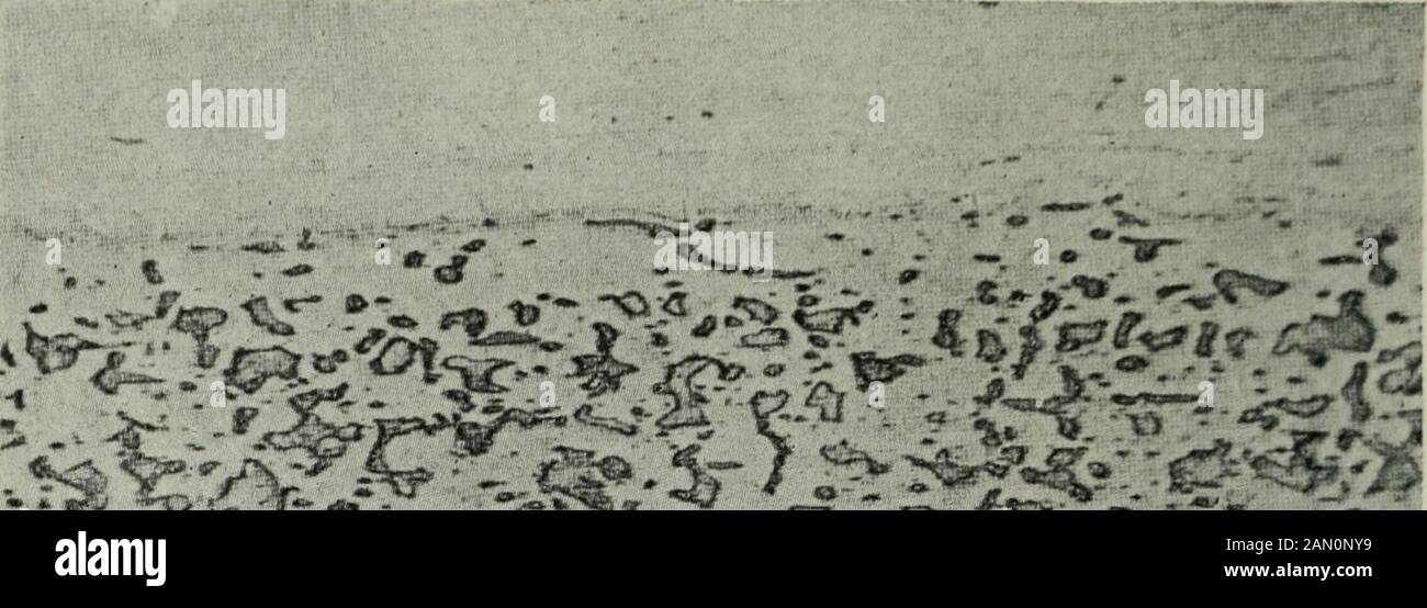 Das Eisen- und Stahlmagazin c-Säure. Abb. 3, das zweihundert Mal vergrößert wird, zeigt den Weg, in dem der Schwefel als Mangansulfid existiert. Eine Einsektion, die einen Geist enthält, wird auf einmal in einem polierten Abschnitt mit einer Ätzung durch das reguläre Band von Mangansulfideinschlüssen gesehen.Das auf dem Foto dargestellte Exemplar wurde sehr geschliffen, um die Position der Hartmetall-Flecken im Verhältnis zu den Mangansulfideinschlüssen zu zeigen. Abb. 4 zeigt das gleiche Exemplar und bei der gleichen Magnifikation, aber tiefer geätzt. Es wird bemerkt, dass die Geisterlinie mehr gelesen hat Stockfoto