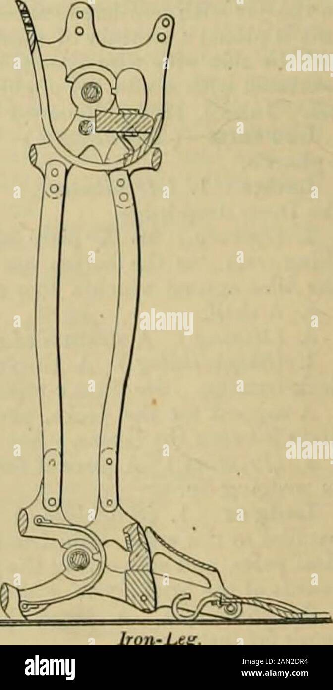 Knight's American Mechanical dictionary: Eine Beschreibung von Werkzeugen, Instrumenten, Maschinen, Prozessen und Ingenieurwesen, Geschichte von Erfindungen, allgemeinem technologischem Wortschatz und der Verdauung von mechanischen Geräten in Wissenschaft und Kunst. Arttjicial Legs. Gepolsterte Buchse, oder sie kann auf die geringere COM-mon-Amputation am Tlie Kniegelenk antworten, die a.xis der Bewegung über der Knieauflage und in Verlängerung der a.xis der Bewegung des Knies, b b sind Verzweigungen der Oberschenkelriemen; Abhängig von den Kniegelenkszweigen, die sich mit dem Tibiapost verbinden und ihn abstützen. Abb. 2895 ist ein für t angepasstes Bein Stockfoto