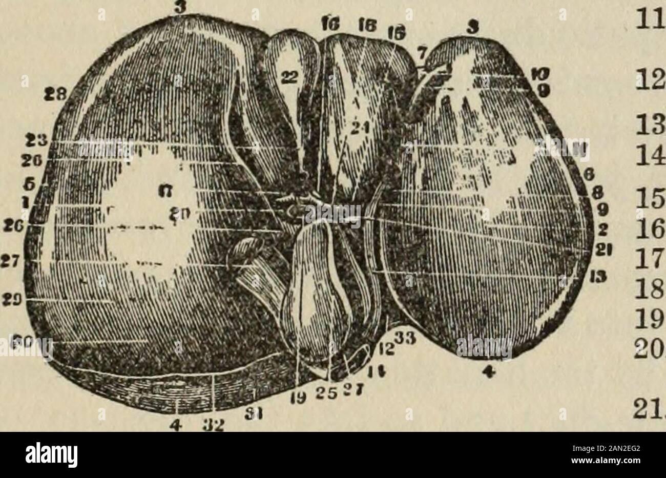 Gesundheitskenntnisse: Ein umfassendes und präzises Wissen über die Prävention, Ursachen und Behandlungen von Krankheiten, vereinfacht für den Hausgebrauch. Geriebt als Thatof eines rechtwinkligen Dreiecksprismas, mit dem rechten Winkel rundweg. Es hat fünf Oberflächen, obere, untere, vordere, hintere und rechte, von denen die Vorder- und Rückseite dreieckig sind, wobei die Grundfläche die rechte Seite hat und nach links abweist. Die Oberflächen Pons hepatis oder das Leberband über das Nabelfissure.Posterior Ende der Längsfissure. {Anhang des oblatedductus venosus an den ascendingvena cava.Transversal fissure.section Stockfoto