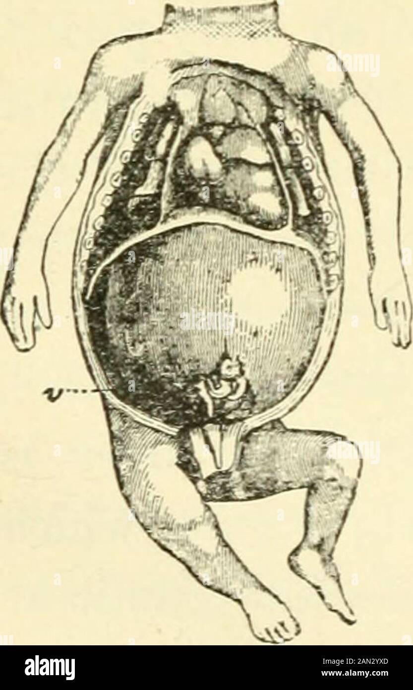 Die Evolution des Menschen: Eine beliebte Exposition der Hauptpunkte der menschlichen Ontogenie und des PhylogenyFroms der Deutsche von Ernst Haeckel . Eat Blutgefäße, die die gesamte Leber durchqueren, und die unzähligen netzartigen Peitschenzweige sind interlacedmit dem Netzwerk der Leberzellen. Die Gallenkanäle, die die gesamte Leber, die CoUectin^^ die Galle und die Discharoinorit in den Darm durchqueren, stammen als interzelluläre Passagen entlang der Evolution des man. Der Achse der Festkörper-Zellschnüre; sie werden alle in die thetwo primitiven Haupt- oder Biliarkanäle geleitet, die von der Basis der beiden Oris ausgehen Stockfoto