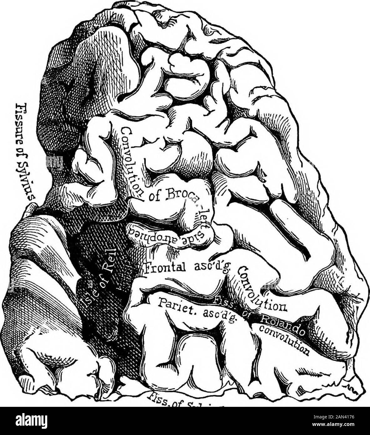Vorträge über die Lokalisierung von Hirnerkrankungen, gehalten an der Faculté de médecine, Paris, 1875. Abb. 12.-Gefäßgebiete der übergeordneten Gehirnoberfläche. (Daret.) Thepottierte Linien zeigen die Territorien der vorderen, mittleren und hinteren Arterie an. Gebiet der dritten Faltung (in ihrem hinteren Teil). Ihere fügt eine schlüssig korrosive Tatsache hinzu. Der Fall war eine Frau namens Farn... beobachtet bei Salpetriere. Sie wurde mit Aphasie angegriffen. Von der paralyse habe es weder Bewegung noch Empfindung gegeben. Aphasie war in diesem Fall 54 ERKRANKUNGEN DES GEHIRNS, das einzige Symptom Stockfoto