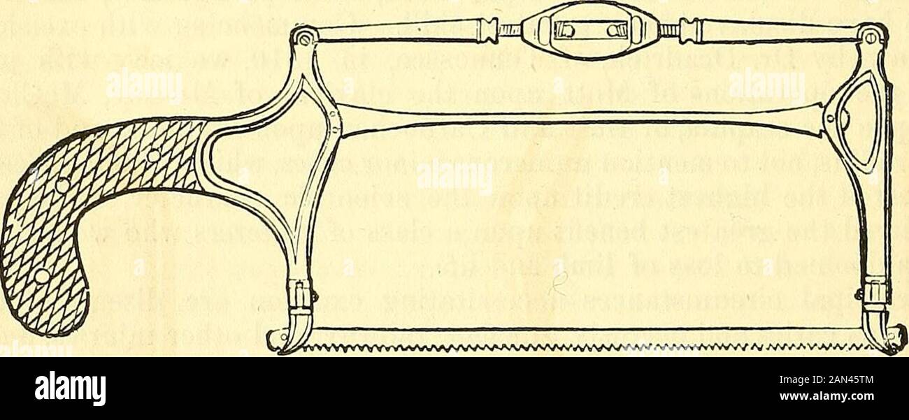Ein chirurgisches System: Pathologisch, diagnostisch, therapeutisch und operativ. Es wurde die Bereitschaft und die erfolgreiche Durchführung dieser Operation erfragt, und es ist immer wünschenswert, etwas zu manythan zu wenig zu haben, damit jeder Notfall sofort erfüllt werden kann, wenn er auftritt. Die Einschnitte durch die Haut und Muskeln werden mit gewöhnlichen Skalpellen hergestellt, aber die Knochen von den weichen Teilen abtrennen und Bänder, Stout, Sondenspitzen Messer, mit breiten, stählernen Griffen, konvex und halbscharf am Ende teilen, sind notwendig. Die Exzision des Knochens erfolgt mit einer Handsäge, einer Zange oder dem gou Stockfoto
