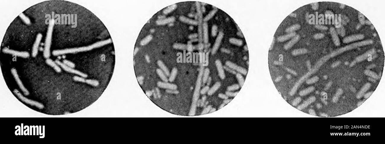 Morphologische Studien im Life-Histories von Bakterien. ] Ich. Shiya-Kruse. X 1500. (ausgewählter Arten.) Stockfoto