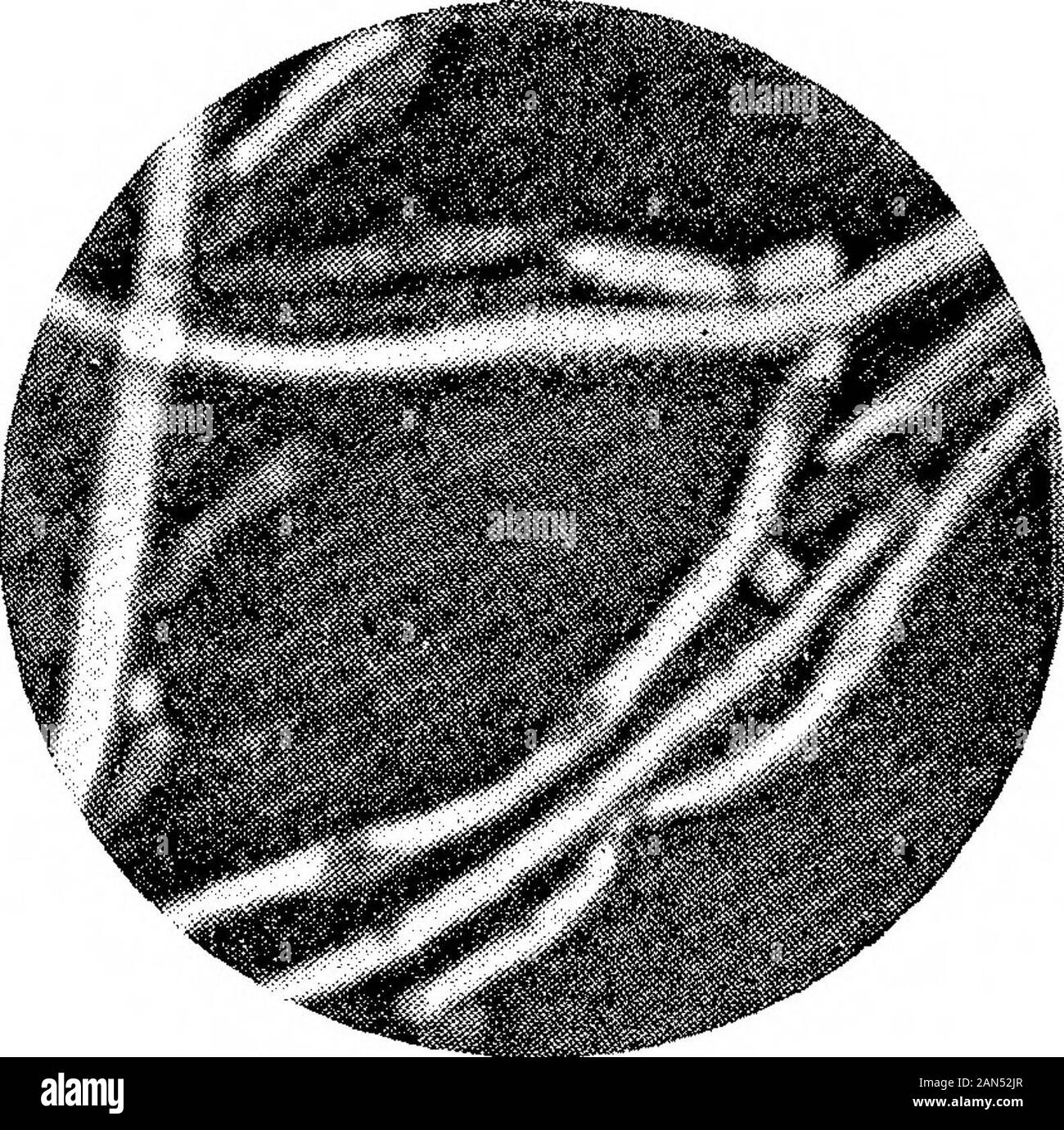 Morphologische Studien im Life-Histories von Bakterien. B. Coli Commwiis. X 1500. (ausgewählter Arten.) Hort. Roy. Soc. Proc, B, Vol. 89, Platte 18. &Lt;s. ? = 1. Stockfoto