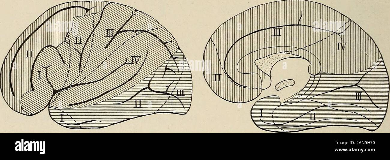Nerven- und Geisteskrankheiten. Abb. 81. - Verteilung der mittleren Gehirnarterie (Duret). Die wichtigsten zerebralen Arterien bis Coursing in den Hemisphären in thearachnopia haben jeweils eine bestimmte kortikale Gebiet, und diese nur slightlyoverlap. Sie geben zwei Zweige, - nämlich, zarte Arteri-Oles, nähren die Rinde, die Sie im rechten Winkel ein, und largerstraight, lange Äste, die Pierce den Cortex und die Versorgung der whitematter des Großhirns (siehe Abb. 66, S. 167). Diesen Pass nach innen und. Abb. 82. - die Verteilung der vorderen, mittleren und hinteren zerebrale Arteri Stockfoto
