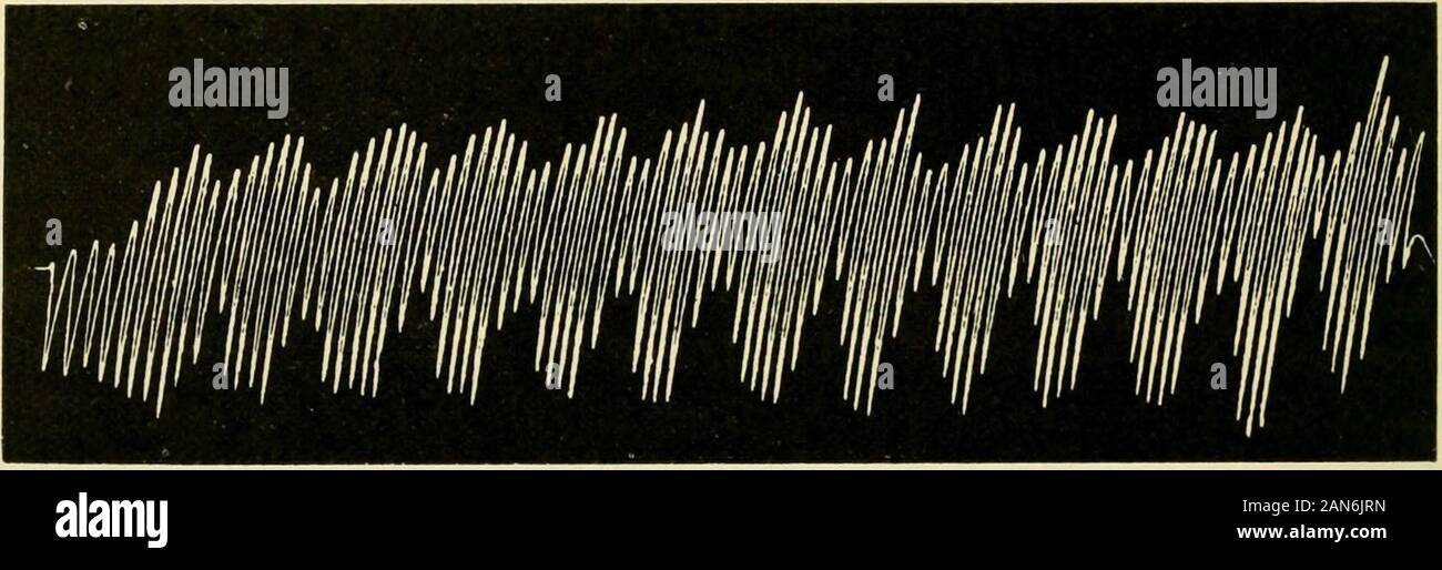 Physiologie und Biochemie in der modernen Medizin. Und nicht 374 DIE ATMUNG  lediglich eine stetig steigende hyperpnea ist wahrscheinlich auf die  un-gleich die Raten, mit denen 02 und C 02 Spannungen im