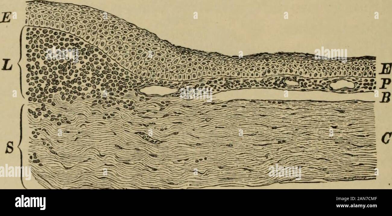 Lehrbuch der Augenheilkunde. r teilt mit, dass der Geschwüre des corneagenerally, eine ausführliche Darstellung des wird zu den latterhead (§§ 197 ff.) gegeben werden. Geschwüre heilen, hinter sich lassen trübe Flecken, von denen theinfluence auf Vision ist abhängig von dem Grad der theiropaqueness und auch auf ihre Lage in Bezug auf die areaof Markushaarmücke bezeichnet die Hornhaut. [Trachom ist auch häufig mit Infektion der lachry - Mals sac kompliziert. Solche Beutel sind sehr brüchig und Bruch einfach (Butler).-D.] Pannus beweist, bei der histologischen Untersuchung, eine Schicht der neugebildeten Gewebes, die zu sein, Stockfoto