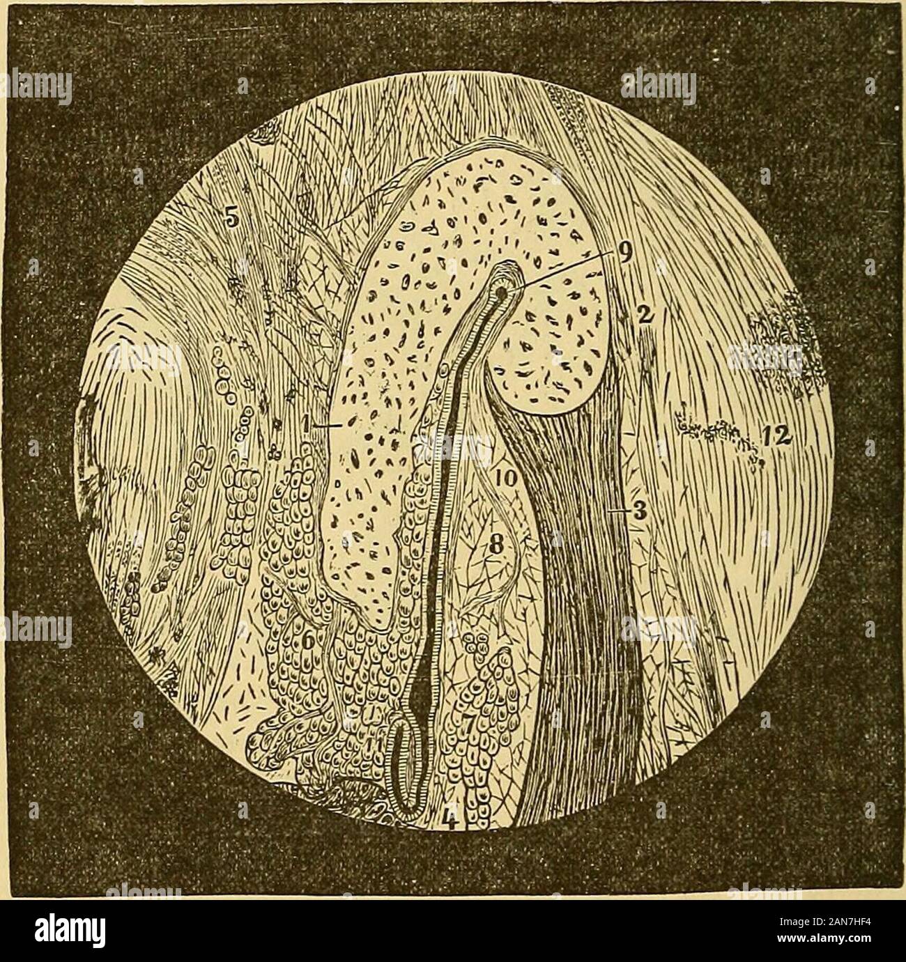 Eine praktische Abhandlung über die Krankheiten des Ohres einschließlich der Anatomie der Orgel. Zeigen upperethmoidal tJie Öffnungen der Zellen. F.S. Frontalis. S. S. Sphenoidal Sinus. 1. Öffnungen von Zinn towerethmoidal Zellen. 2. Sonde in der Mitte der Nase Platz aus - der Sinus frontalis. 3. Die Konstante Öffnung zwischen dem antrum des Oberkiefers und die Nasenhöhle. 4. Occa - vorläufige Öffnung zwischen dem sameparts. 5. Pharyngeal Öffnung der Eustachischen Röhre. Die seitliche Wand des Rohrs, der mit seinen oberen Grenze, Grenzen der konvexen Oberfläche der Kuvertierung Grat der Auto - 212 Eustachische Röhre. Stockfoto