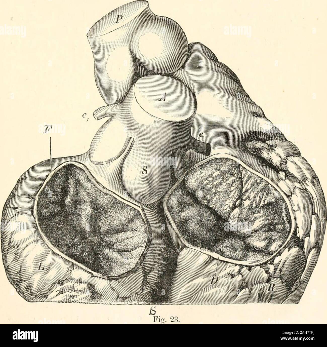 Ein Handbuch der menschlichen Physiologie, einschließlich der Histologie und mikroskopischen Anatomie, unter besonderer Berücksichtigung der Erfordernisse der praktischen Medizin. omenarrowed (Haller, nysten) aufgrund der Einschränkung ihrer circularmuscular Fasern (insbesondere die Vena cava superior und thepulmonary Venen). (2.) Das Congelador Wände Vertrag gleichzeitig in Richtung der auriculo-ventrikulärer Ventile und die venöse Öffnungen, wobei EREIGNISSE WÄHREND EINES HERZZYKLUS. 77 (3.) Das Blut wird in der entspannten Ventrikel, die wesentlich erweitert damit getrieben. Die Kontraktion der Ohrmuscheln ist gefolgt von (a.). Stockfoto