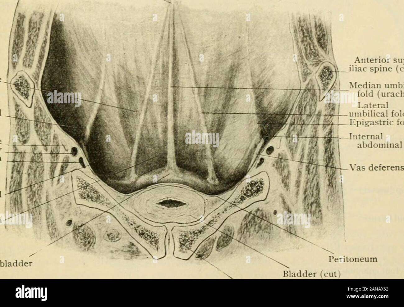Der menschlichen Anatomie, einschließlich der Struktur und Entwicklung und praktischen Erwägungen. Pouparts Ligament. Eine leichte Falten, durch die samenleiter oder das Ligamentum verursacht, ist als laufende downwardfrom den Ring in das Becken beschrieben; Tatsache ist jedoch, dass die Struktur kann onlyindistinctly durch das bauchfell gesehen werden, und einen erhöhten Falten ist selten. Es bildet hebendie äußeren Grenze des leicht markedyrw^ ra/Depression (Fovea femoralisj gegenüber thefemoral Ring (Annulus Cruralis), zwischen den pubes und Pouparts Ligament. Theperitoneum ist seitlich auf beiden Seiten fortgesetzt, ohne dass irgendwelche featu Stockfoto