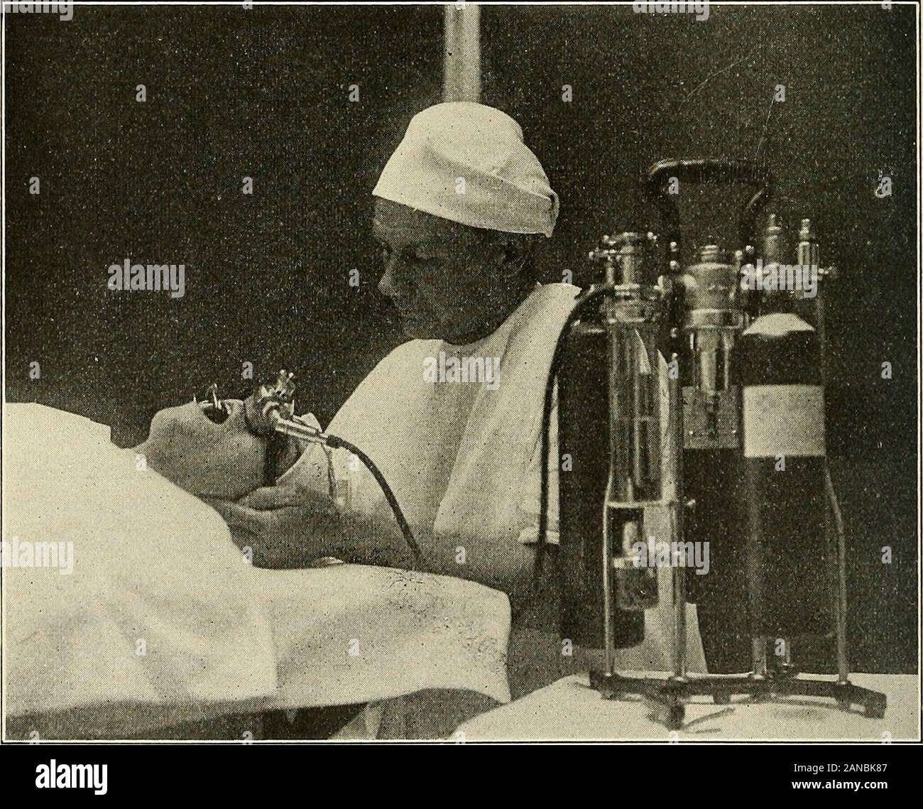 Anästhesie. Abb. 59.- Gwathmey-Woolsey Lachgas Oxid-Oxygen Apparate wie in Gen- Chirurgie. Abb. 60.- Gwathmey-Woolsey Lachgas Oxid-Oxygen Apparate im Adenoiden und Tonsillen. Und STICKOXID 175 Position bis zur Bewusstlosigkeit folgt. Die Manschette ist dann downand um den Hals befestigt ist; es wird nun selbst haltend. Wenn thepatient ist eine kräftige alkoholische oder einem nervösen Individuelle, den Beutel shouldbe teilweise mit Stickoxid alleine gefüllt. Wenn das Gas ist, von zwei auf sechs Atemzüge gedreht, entsprechend der Patient, sollte allowedthrough Ventile werden; die verschiebbare Manschette ist dann herausgezogen Stockfoto