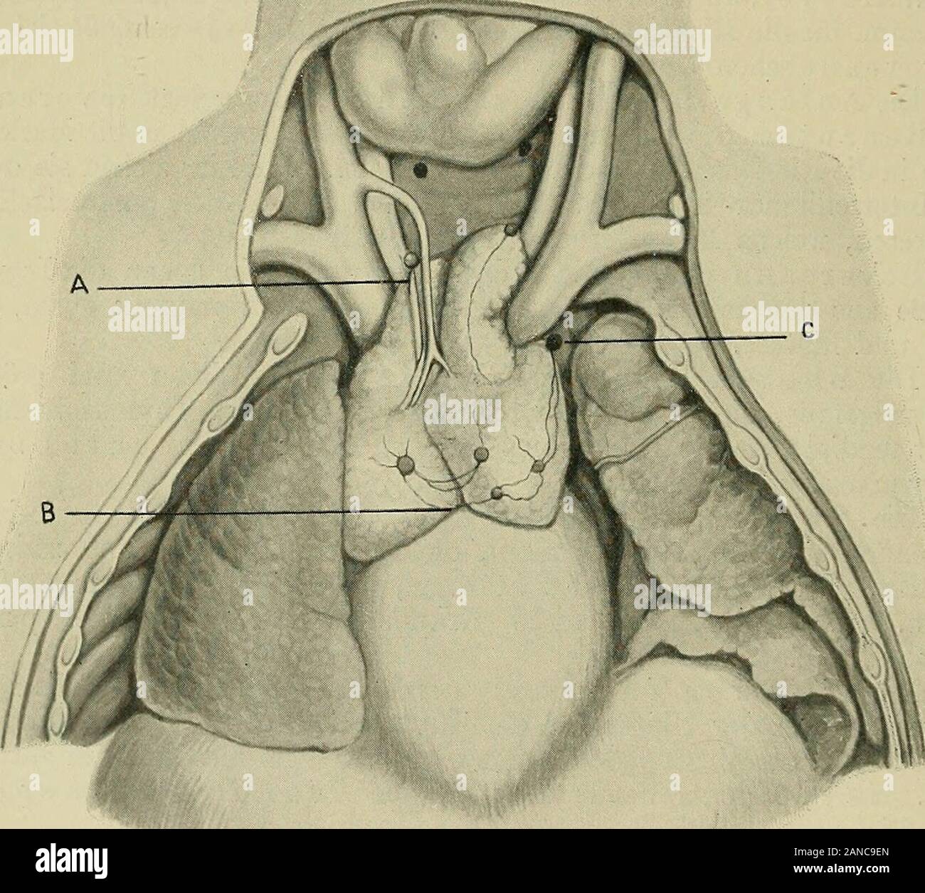 Chirurgie der Thymusdrüse. eder selbständig oder vereinigt, mit dem