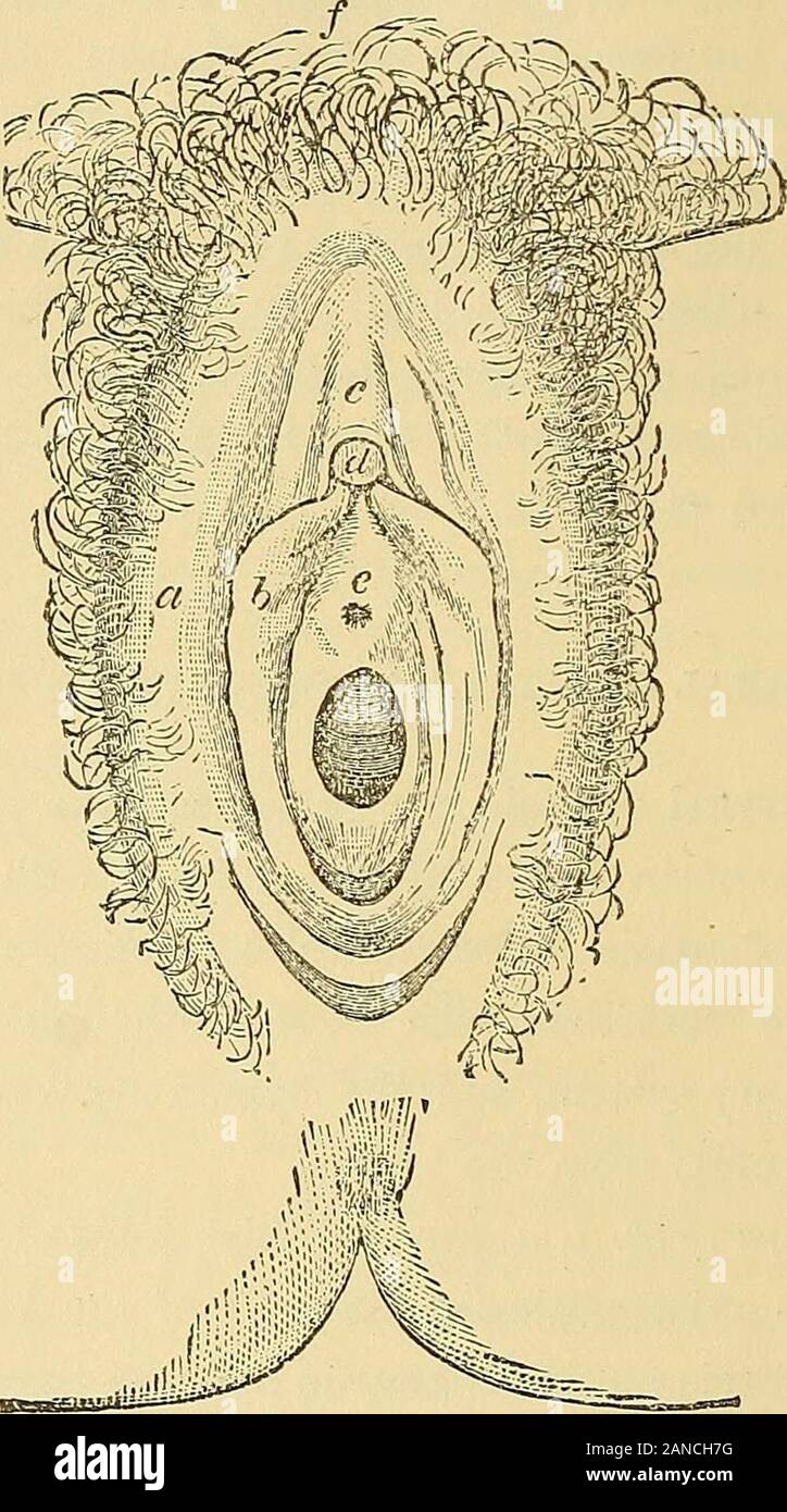 Handbuch der Geburtshilfe. oped, sie bilden durch ihre Kreuzung - anterior Commissure - die Struktur bekannt als der Venushügel (videPlate I.); während Posterior, sie sind eine reine Falte der Haut bekannt als theFourchette oder posterioren Commissure. Der Fett- und Bindegewebe aretherefore fast vollständig wollen am fourchette, der nicht eine distinctstructure, sondern ist einfach der posterioren Kreuzung der Ausgedünnten labiamajora. Beide Schamlippen, in der Erwachsenenbildung, mit frischen Haare, die ismost reichlich über den Venushügel und äußeren Oberfläche, aber sehr muchless auf der Innenseite abgedeckt. 4 HANDBUCH FÜR GYNÄKOLOGIE. Die Schamlippen Stockfoto