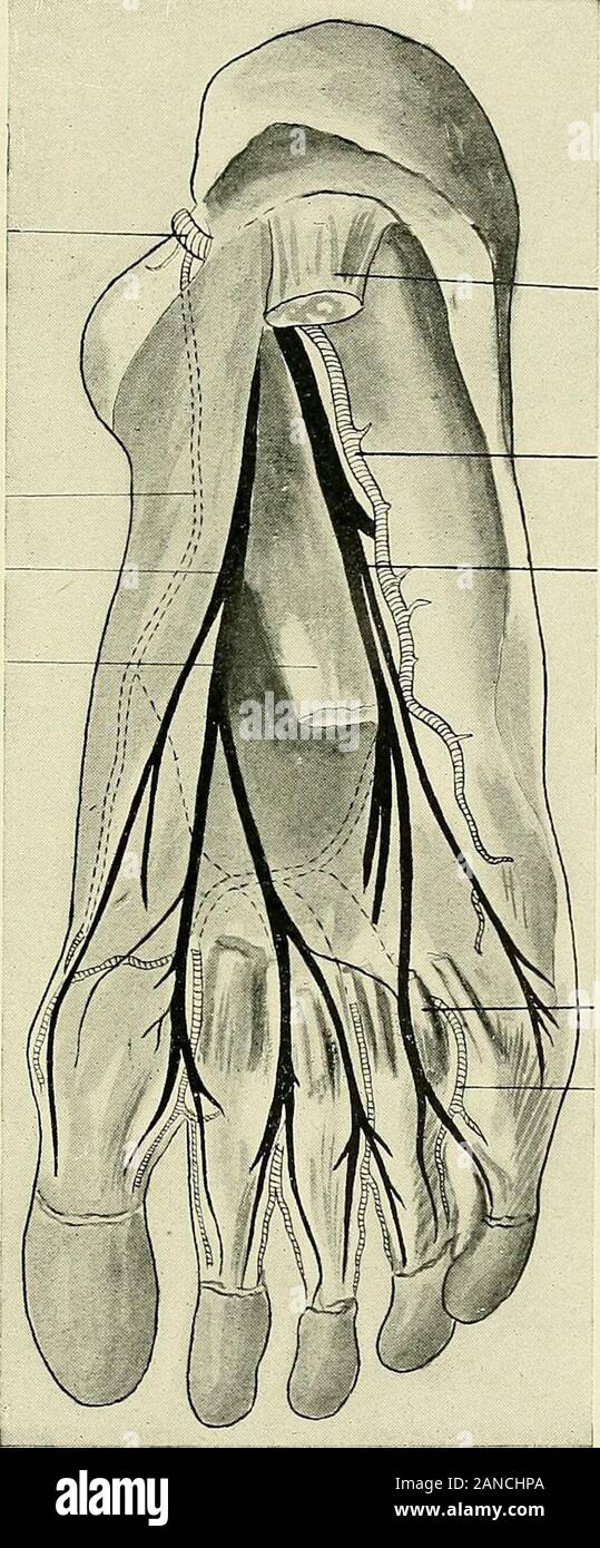 Ein text-Buch der klinischen Anatomie: für Studenten und Praktiker. Extensor hallucis brevis Anterior tibial ordeep peronaeus nerveInternal saphenousvein ist-Metatarsal arterv Externe saphenous Nerv (yellowExternal Saphenous Vein (schwarz) Peroneus longus tendonPeroneus brevis Sehne äußeren malleolusExternal saphenousnerve Peronealtendon-Ummantelung Peronealsheath Entführer seiner antireflektiven V Extensor brevis digi-thorum eroneus tertius Abb. 158,- Dissektion der Dorsum des Fuß: Arterien, punktiert; Nerven in gelb dargestellt - Adern schwarz (Frohse). 493 posterior tibial Artery p Interne plantar Arterie - Interne plantar Nerv Stockfoto