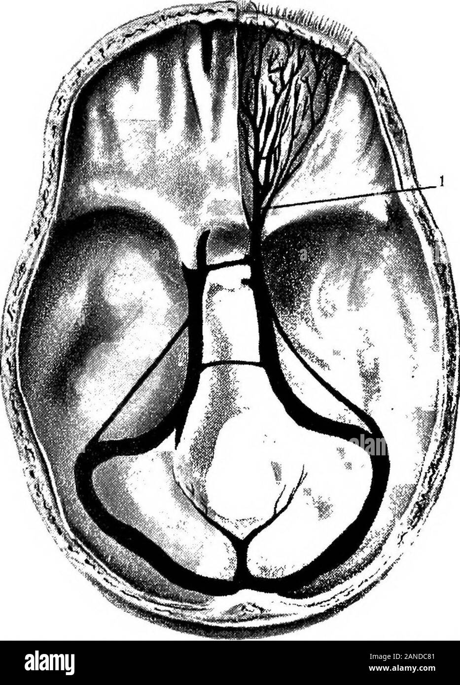 Eine bebilderte Medizinische encyclopaedic dictionaryBeing ein Wörterbuch der technischen Begriffe von Schriftstellern auf die Medizin und die Sicherheiten, die in der Lateinischen, Englischen, Französischen und Deutschen Sprachen. in die Vena cava inferior, wo es in seiner Versichern liegt. Sie sind in der Substanz der Leber auftreten als interlobular Vs [L.] - Hyaloid v. v. begleitet die hyaloid Arterie. [L.] - siehe Hypogastric v. Iliaca v.-ILEO - Koliken v. SeeVena coZico jico -.- Darmbein vs. Die gemeinsame Außen- und internaliliac vs. L" i 34.] - Ilio - Lendenwirbelsäule vs. Lat., Vence Ilio - lumbales. Vs aus dem hinteren Teil der Bauchdecke, Stockfoto