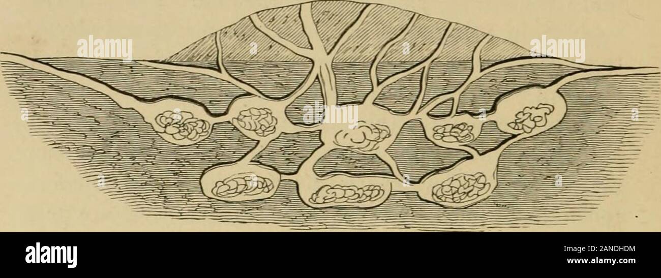 Der Naturforscher in Nicaragua: eine Erzählung einer Residenz an der Goldminen von Chontales; Fahrten in den Savannen und Wäldern; mit Beobachtungen an Tieren und Pflanzen in Bezug auf die Theorie der Evolution der lebenden Formen. Sie sind in Wirklichkeit Mushroom Growers und Esser. Diese Erklärung ist soextraordinary und unerwartet, dass ich Pro-mitted etwas ausführlich über die Fakten zu betreten werden können mir thatled, ihn zu verabschieden. Als ich zuerst anfing, meine warfareagainst die Ameisen, mein Garten angegriffen, grub ich downdeeply in einige ihrer Nester. In unserem Bergbau Opera- tionen auch wir, bei zwei Gelegenheiten, unsere Exc Stockfoto