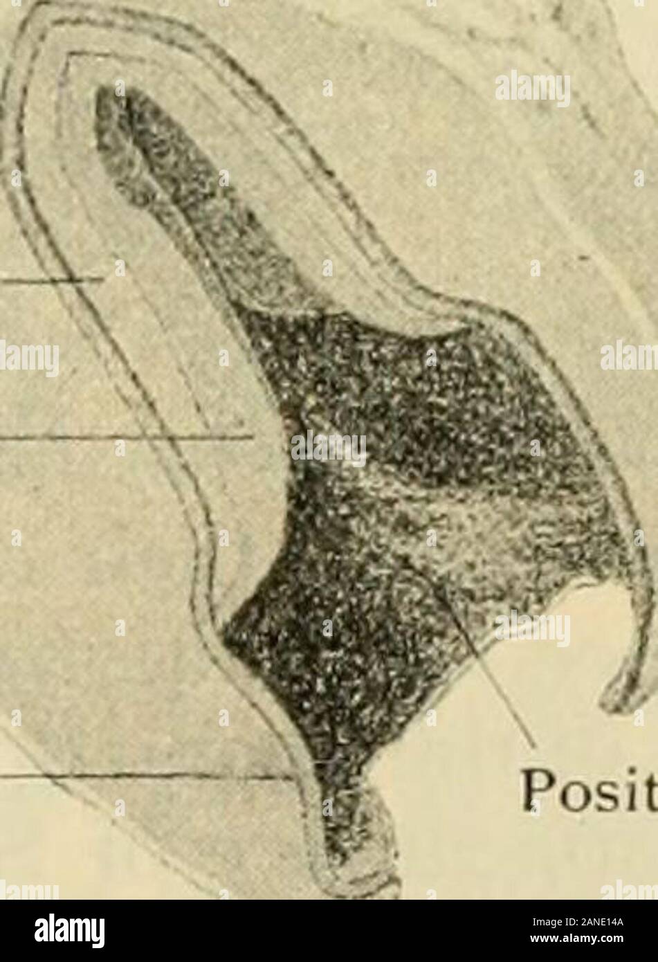 Der menschlichen Anatomie, einschließlich der Struktur und Entwicklung und praktische Erwägungen. e-Zellen messen ab. 025-040 mm in Länge und aus.004-.007 mm in der Breite. Sie besitzen eine ovale Kern über 0,010 mm. lang, in der Regel liegt in der Nähe des äußeren Ende der Zelle, im Zytoplasma Exponat embedded-Ing eine Retikulum und oft minute Granulat. Die ameloblasten vereint mit oneanother durch eine kleine Menge von Zement - Substanz, und sind von der interme definiert - diate Schicht durch eine ziemlich eindeutige Grenze. Gegenüber den Seiten der zahnmedizinischen Papilla, Cor-respontiing bis an die Grenzen der Zukunft Krone, der ameloblast Stockfoto